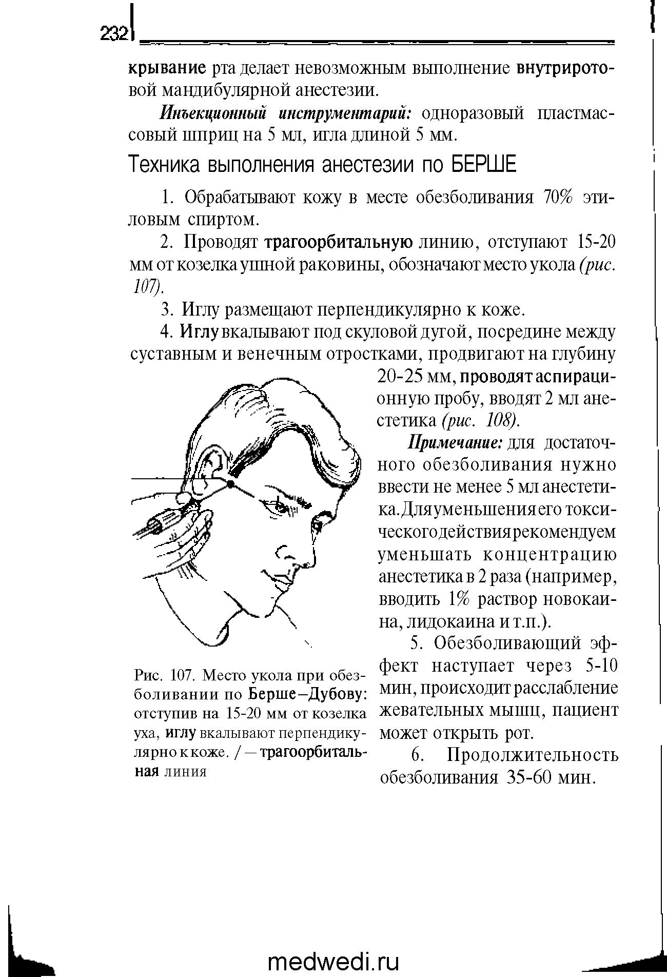 Рис. 107. Место укола при обезболивании по Берше-Дубову отступив на 15-20 мм от козелка уха, иглу вкалывают перпендикулярно ккоже. / — трагоорбиталь-ная линия...