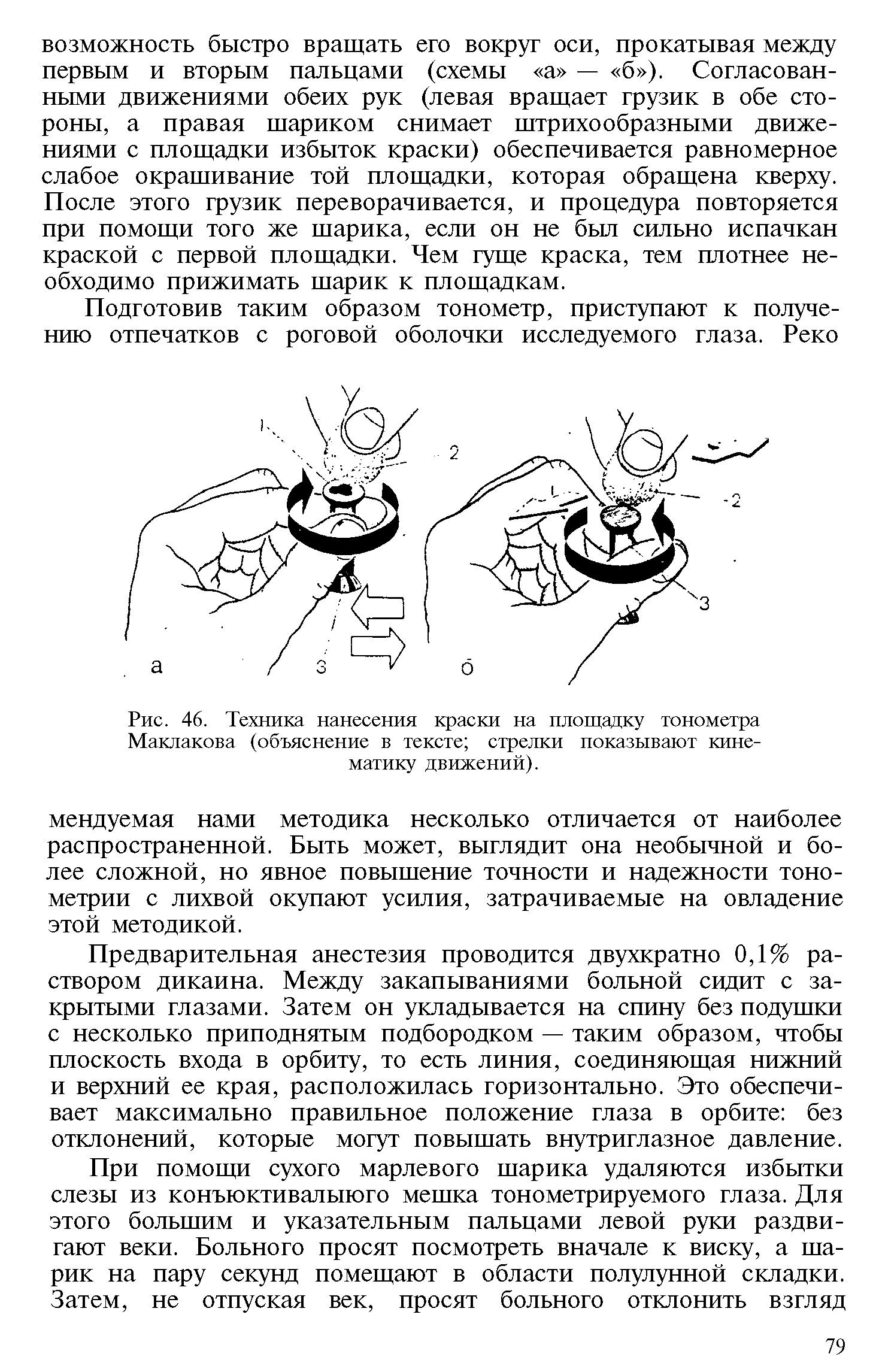 Рис. 46. Техника нанесения краски на площадку тонометра Маклакова (объяснение в тексте стрелки показывают кинематику движений).