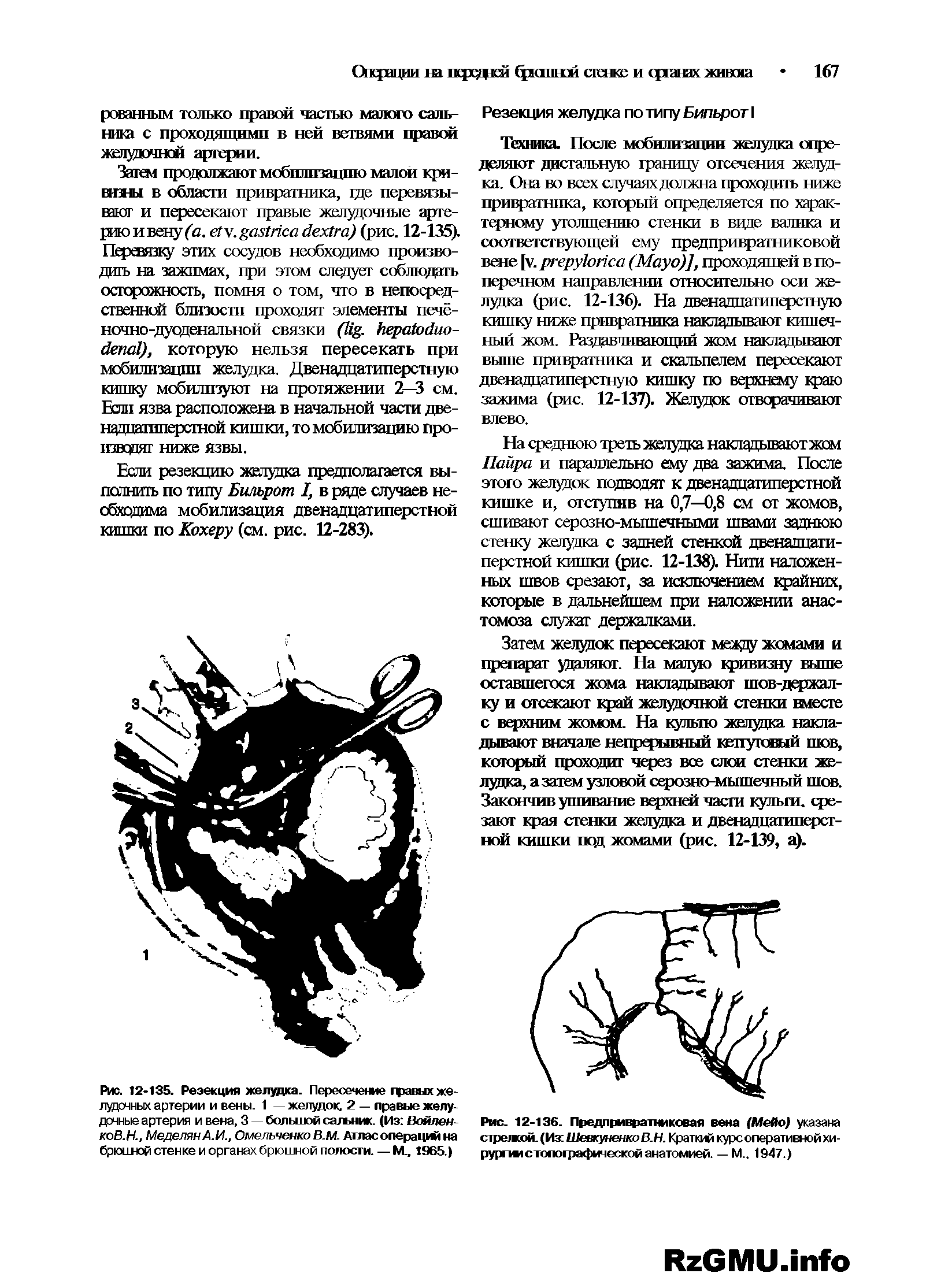 Рис. 12-136. Предпривратниковая вена (Мейо) указана стрежой. (Из ШеекуненкоВ.Н. Краткий курс оперативной хи-рурпмстопографической анатомией. — М.. 1947.)...