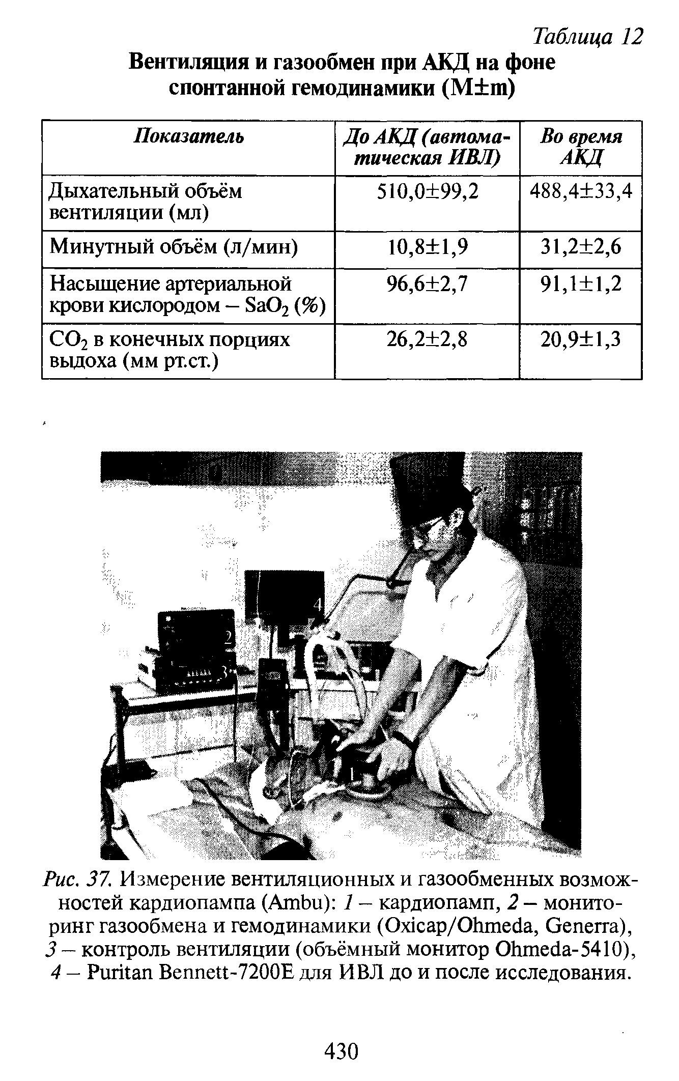 Рис. 37. Измерение вентиляционных и газообменных возможностей кардиопампа (A ) 1 — кардиопамп, 2 — мониторинг газообмена и гемодинамики (O /O , G ),...