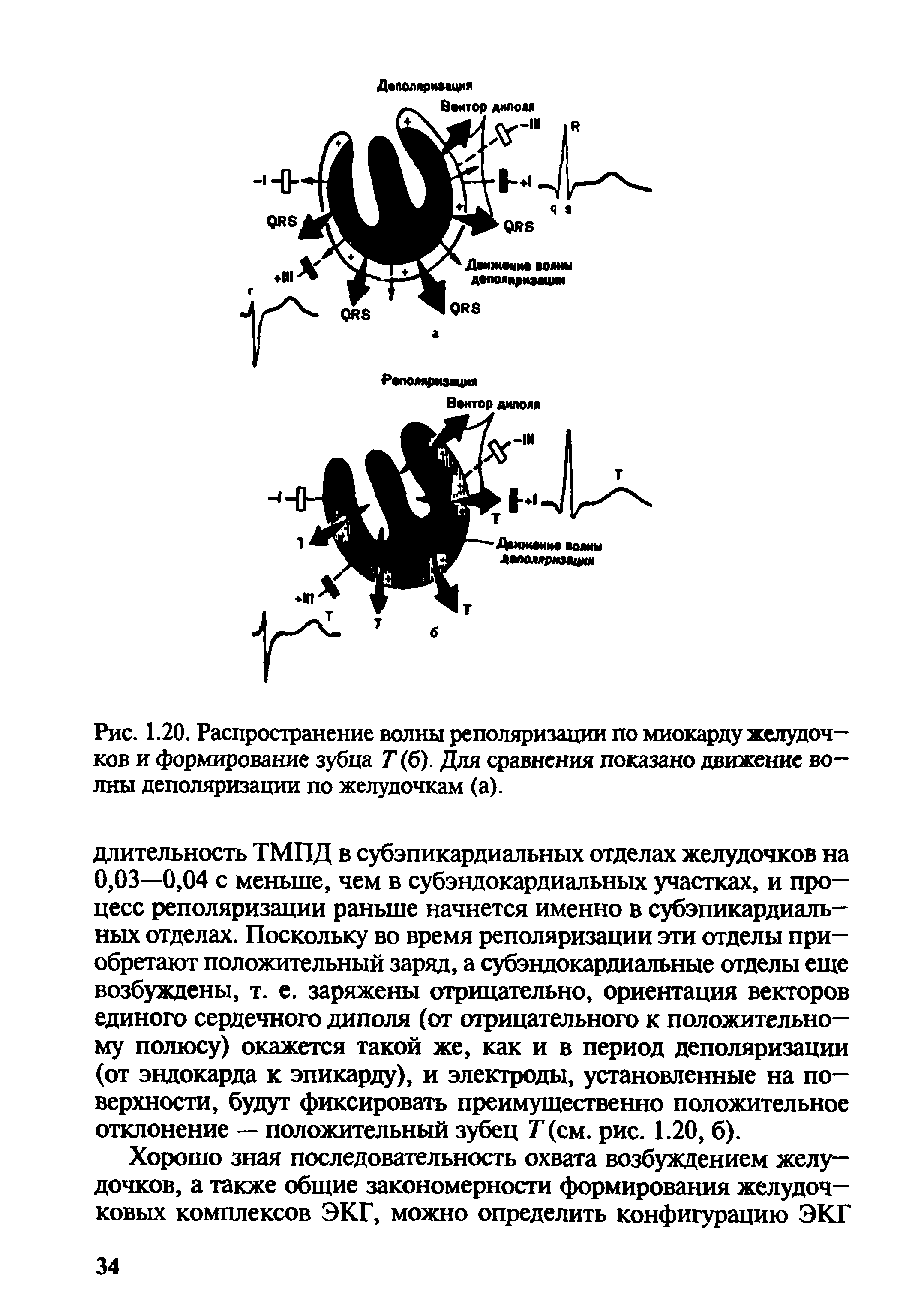 Рис. 1.20. Распространение волны реполяризации по миокарду желудочков и формирование зубца 7(6). Для сравнения показано движение волны деполяризации по желудочкам (а).