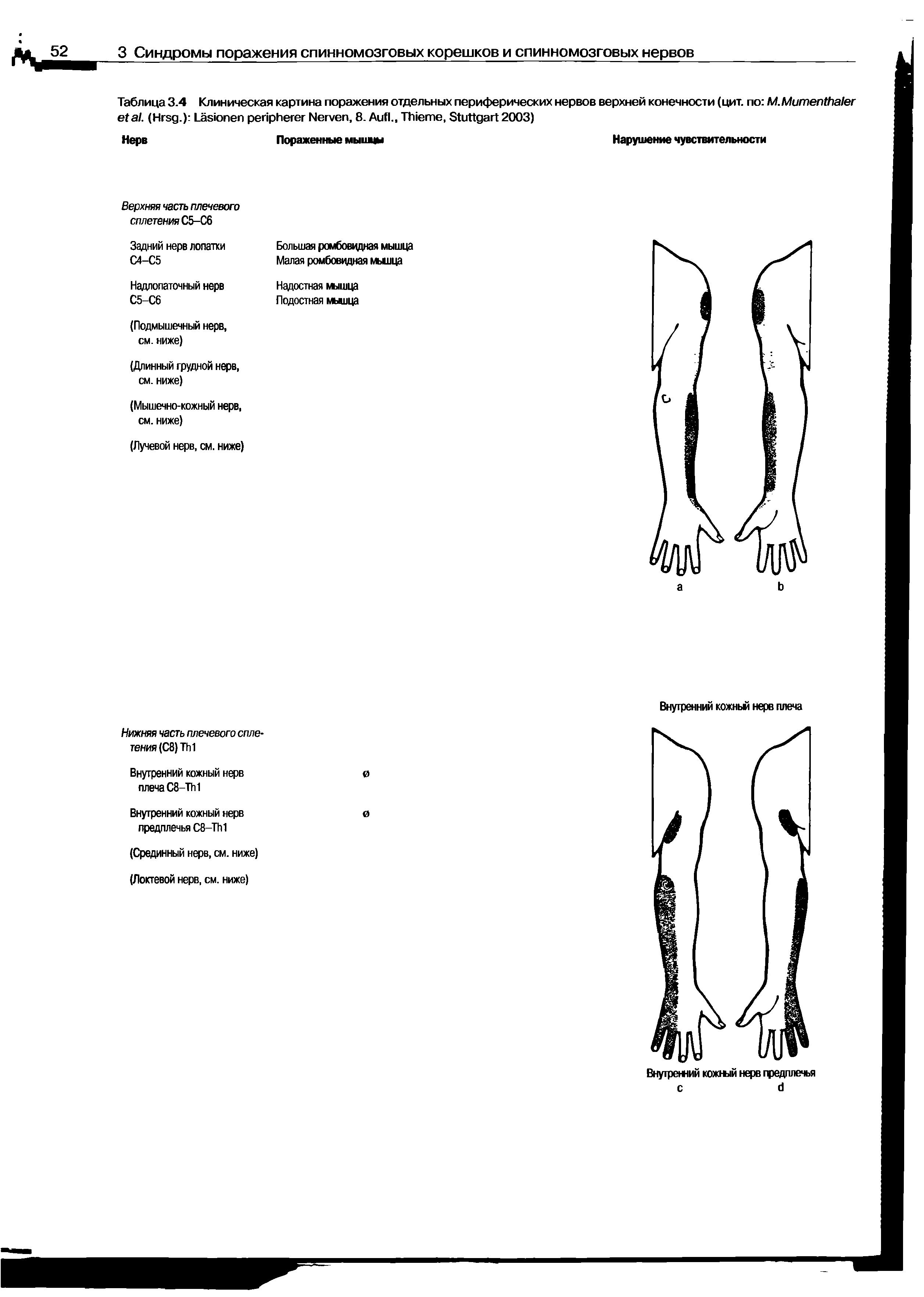 Таблица 3.4 Клиническая картина поражения отдельных периферических нервов верхней конечности (цит. по M.M . (H .) L N , 8. A ., T , S 2003)...