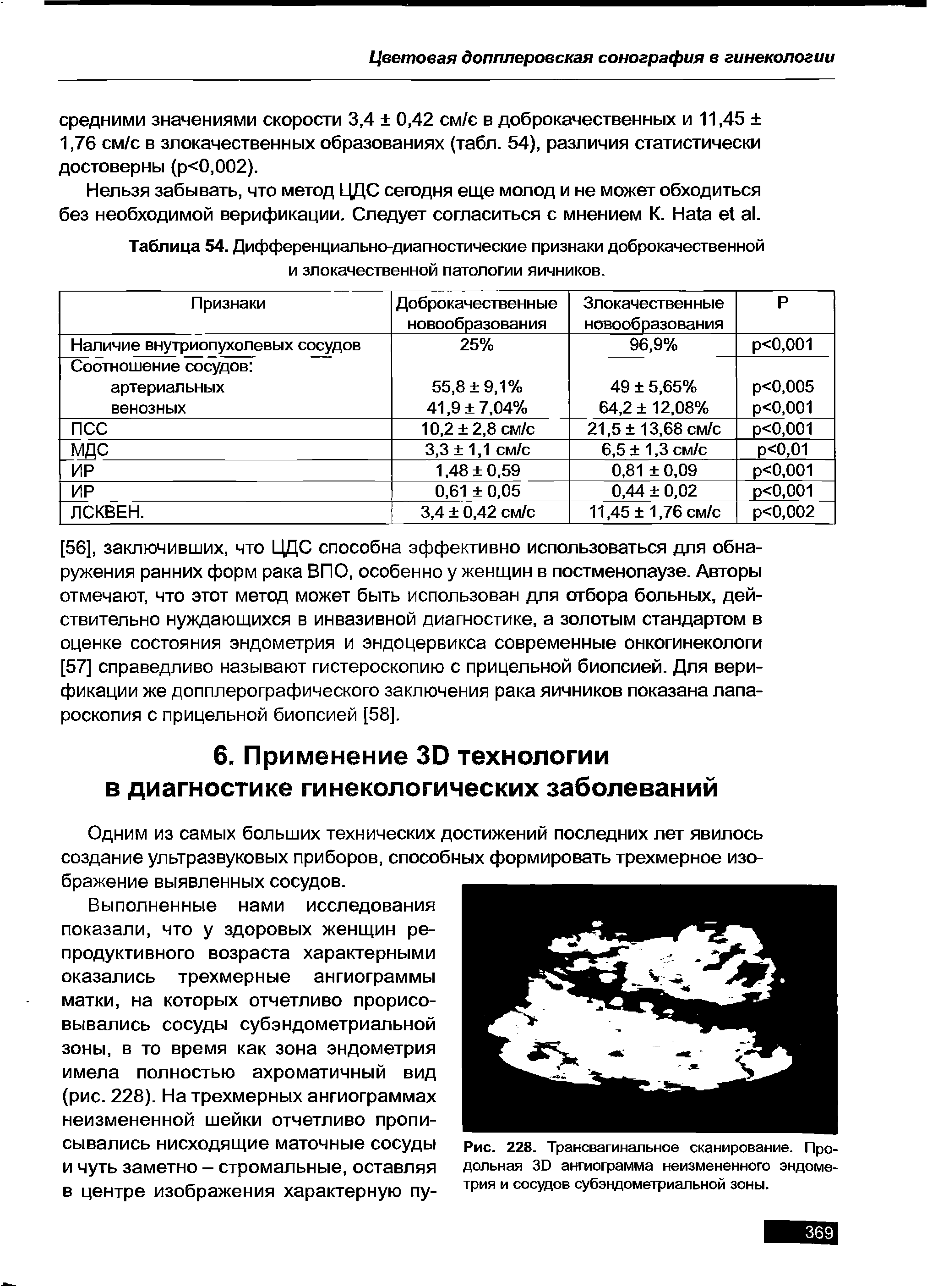 Таблица 54. Дифференциально-диагностические признаки доброкачественной и злокачественной патологии яичников.