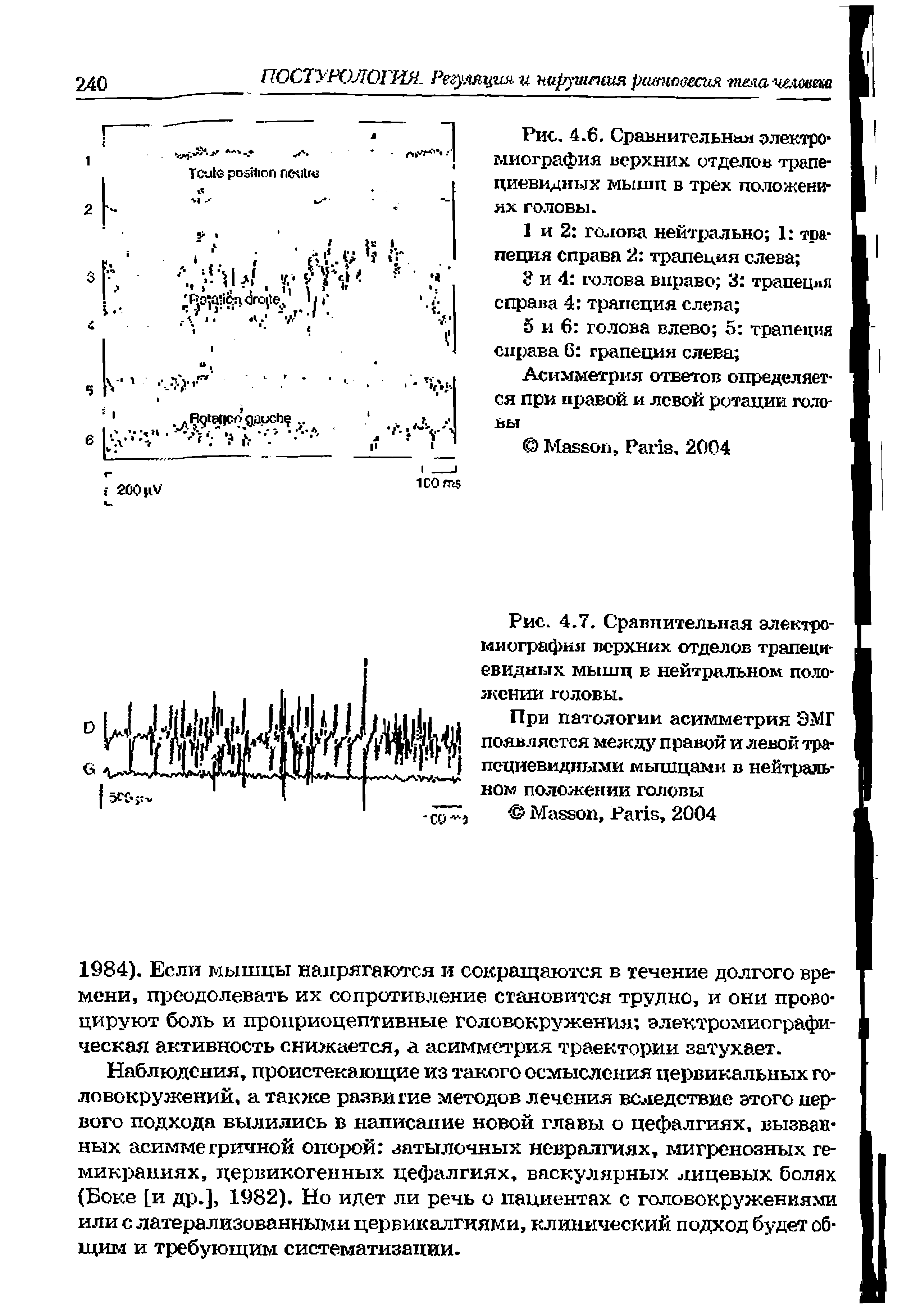 Рис. 4.6. Сравнительная электро миография верхних отделов трапециевидных мыши в трех положениях головы.