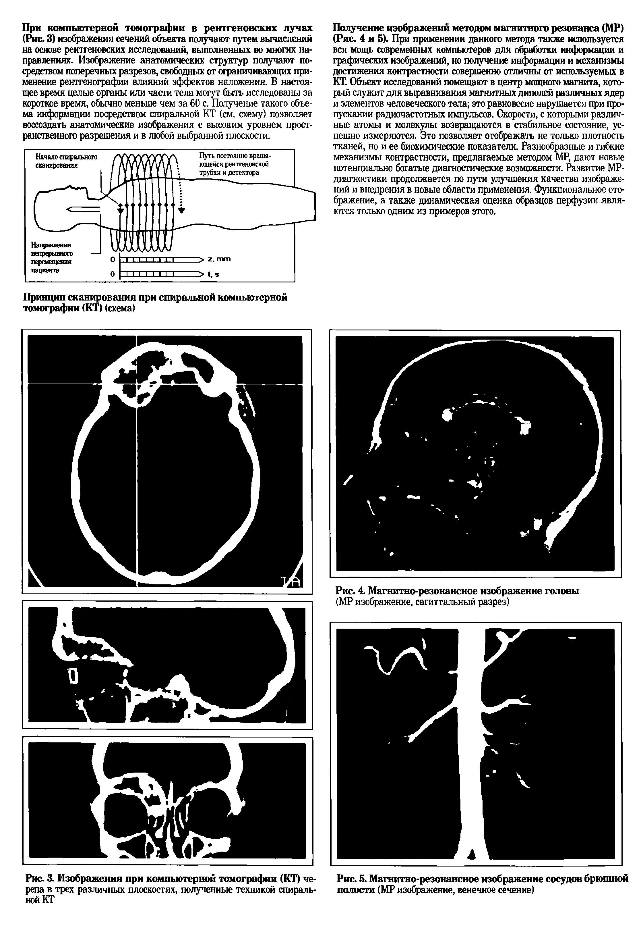 Рис. 4. Магнитно-резонансное изображение головы (МР изображение, сагиттальный разрез)...