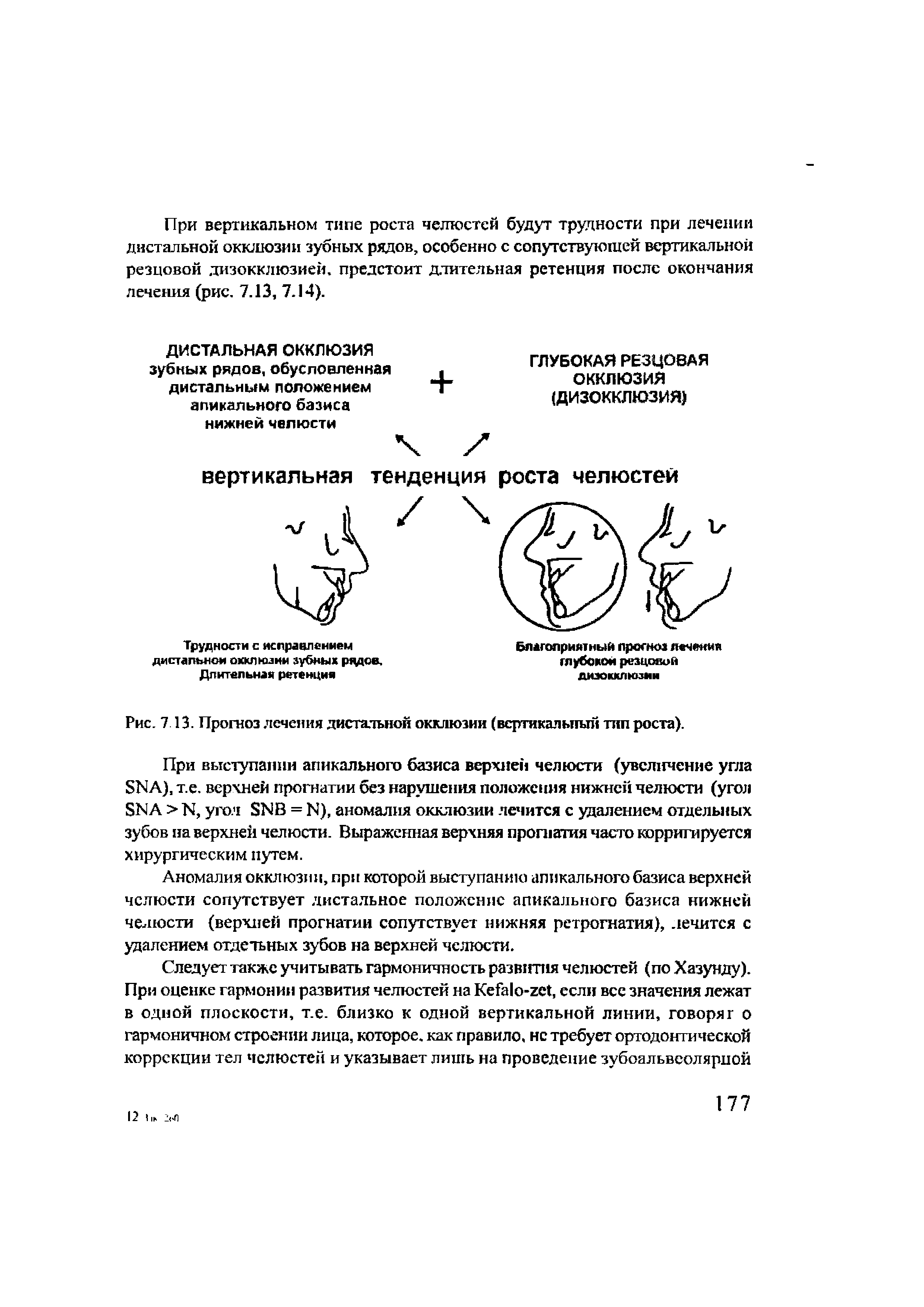 Рис. 7 13. Прогноз лечения дистальной окклюзии (вертикальный тип роста).