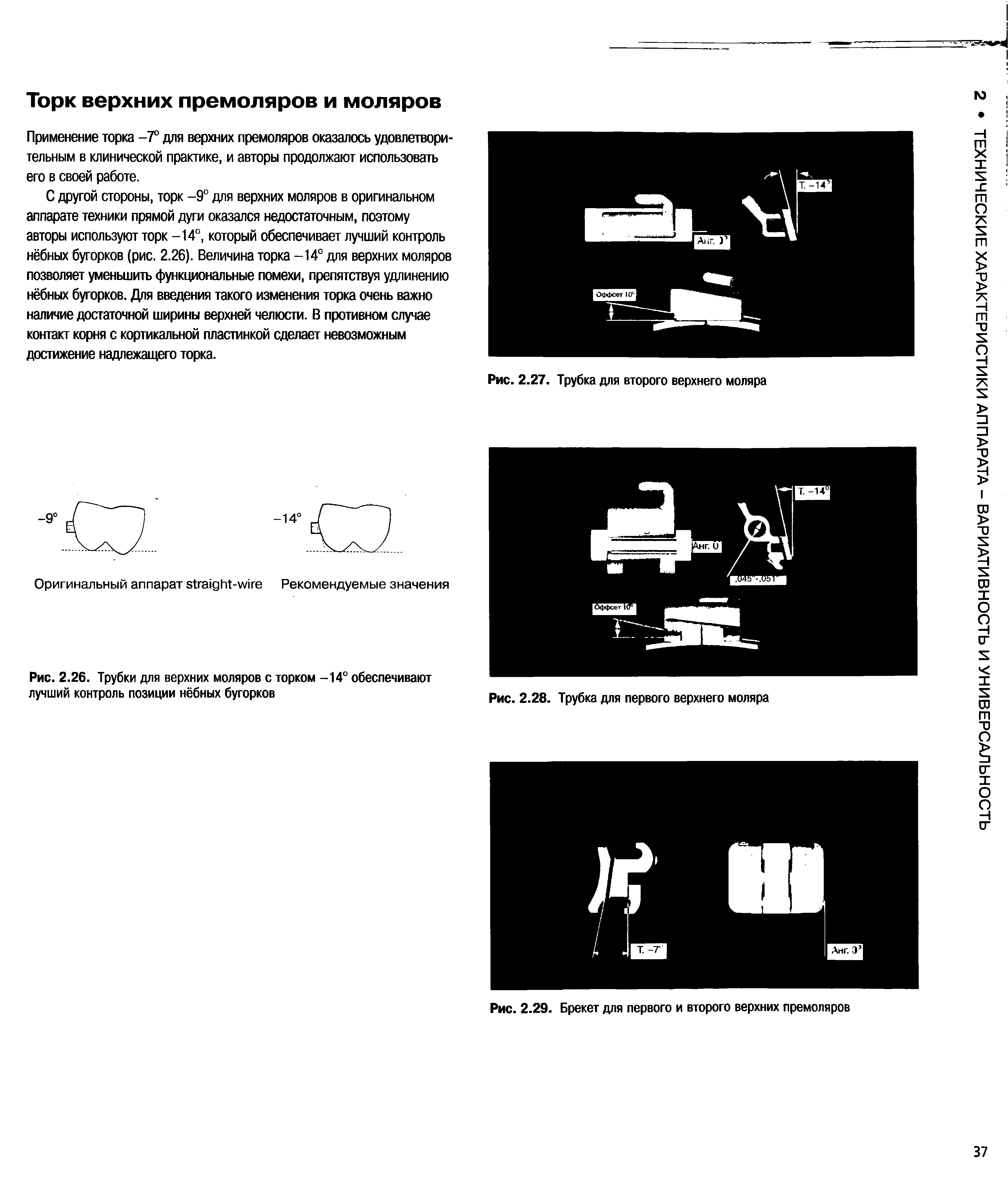 Рис. 2.26. Трубки для верхних моляров с торком -14° обеспечивают лучший контроль позиции нёбных бугорков...