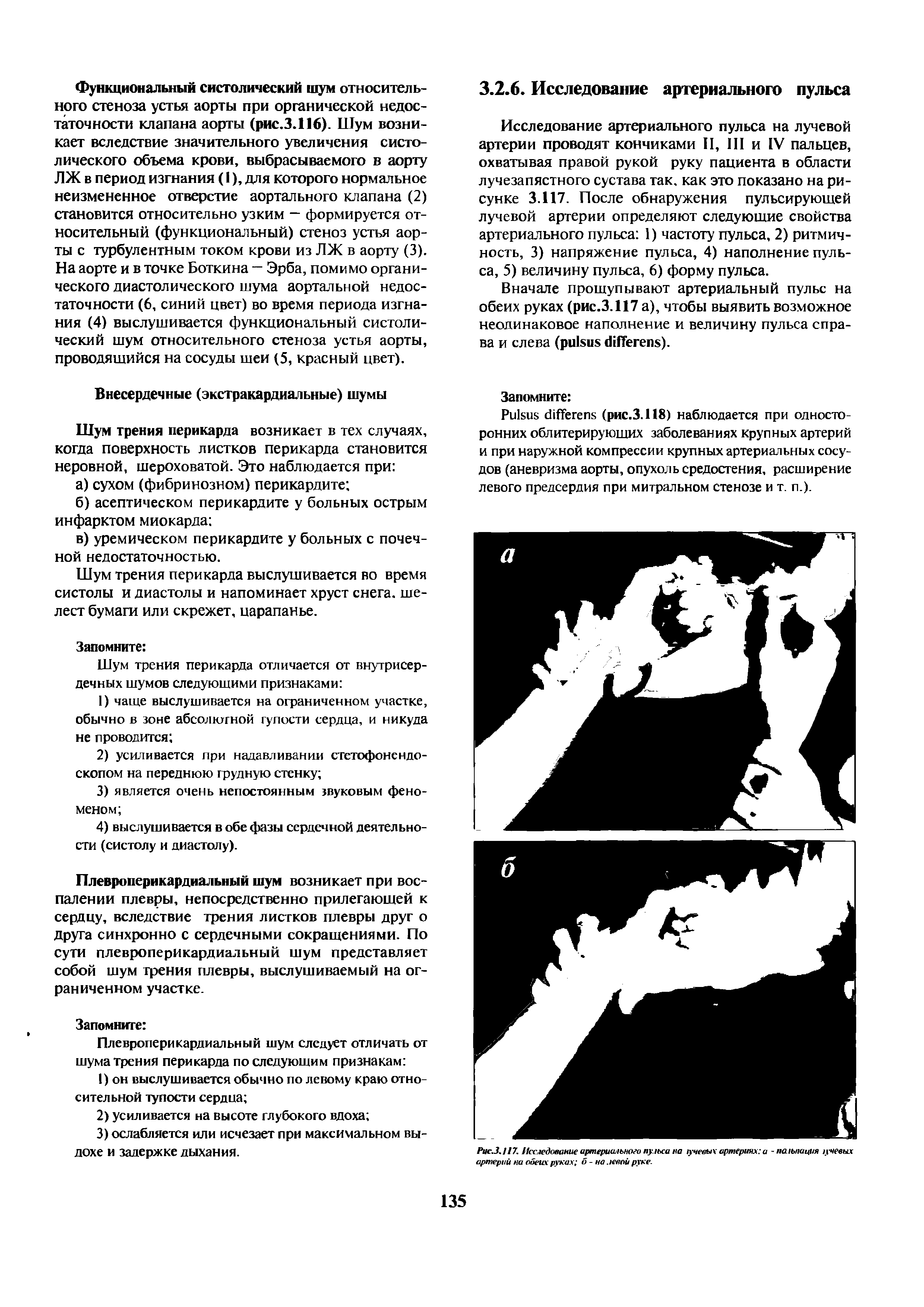 Рис.3.117. Исследование артериального пульса на /ученыхартериях а -пальпация учевых артерий на обеих руках б - на левой руке.