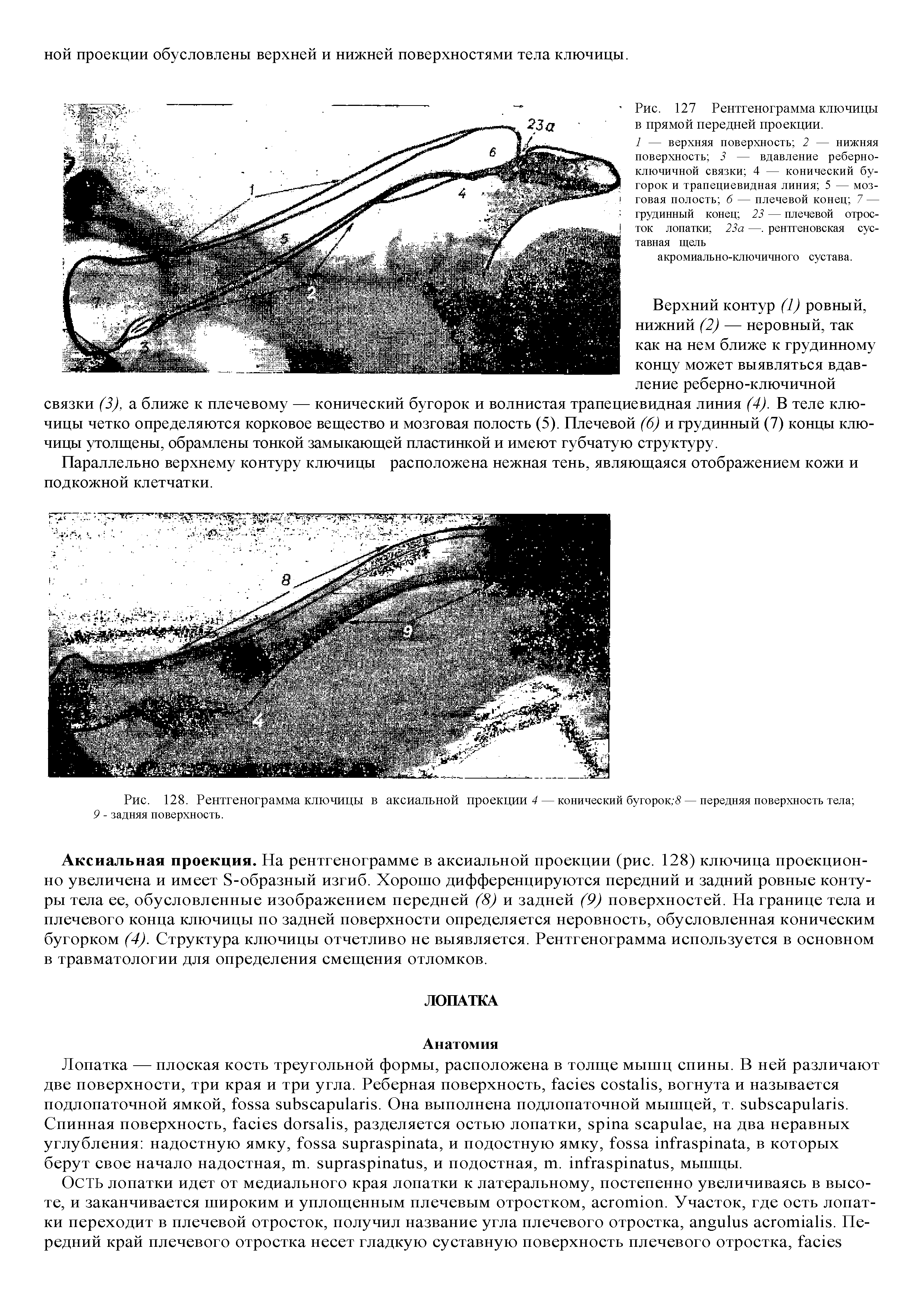 Рис. 128. Рентгенограмма ключицы в аксиальной проекции 4 — конический бугорок,-8 — передняя поверхность тела 9 - задняя поверхность.