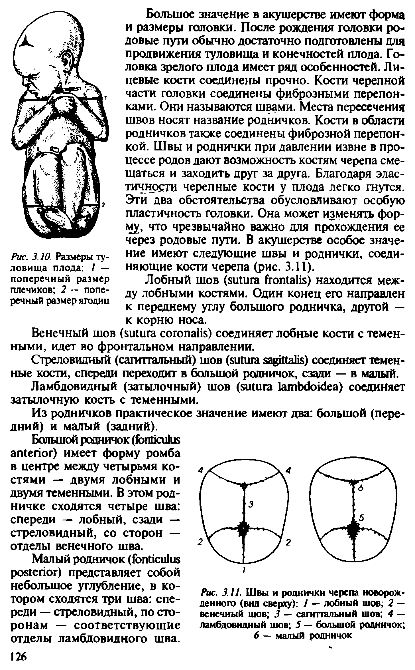 Рис. 3.11. Швы и роднички черепа новорожденного (вид сверху) 1 — лобный шов 2 — венечный шов 3 — сагиттальный шов 4 — ламбдовидный шов 5 — большой родничок ...