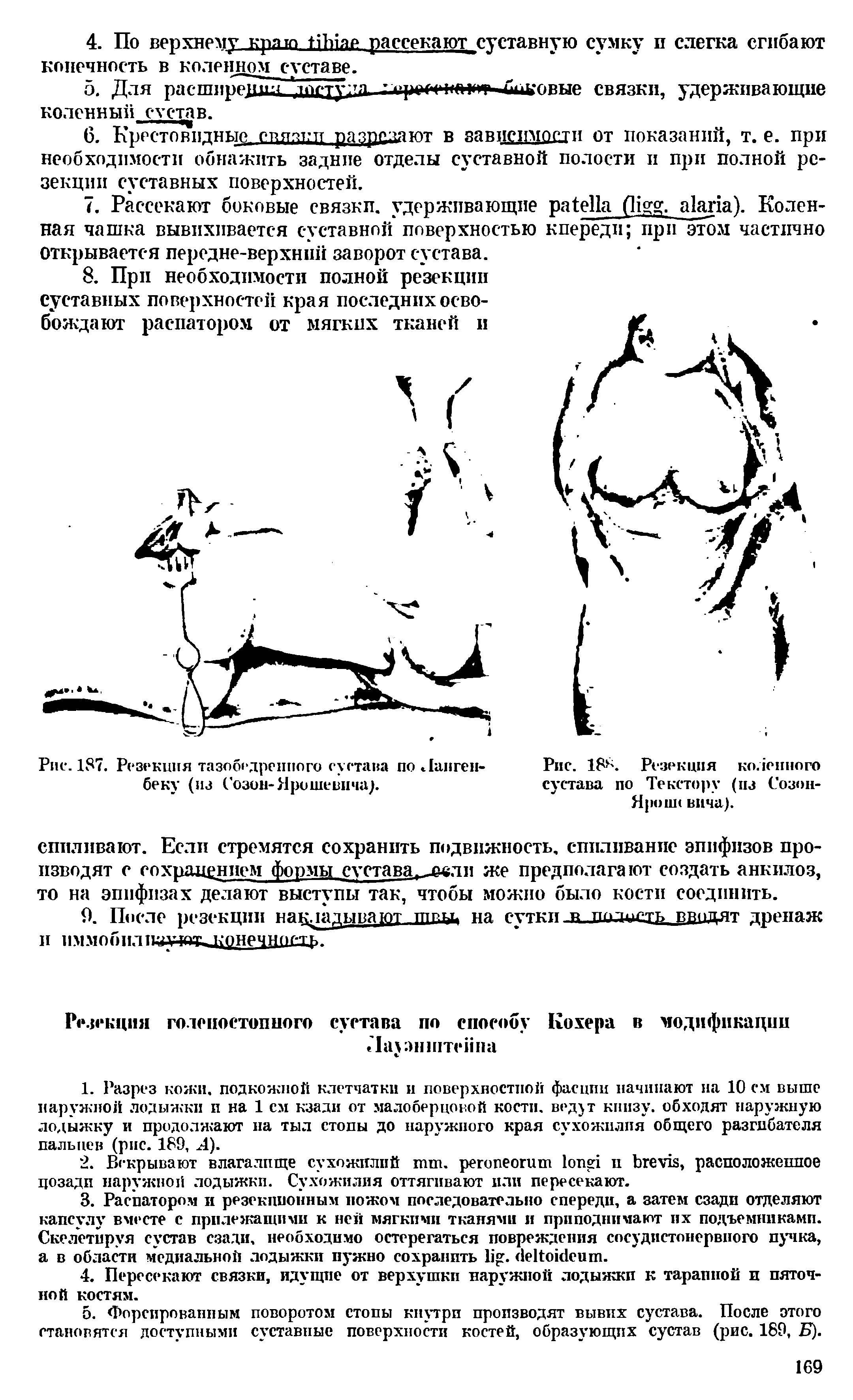 Рис. 18-. Резекция коленного сустава по Текстору (из Созон-Ярош< вича).
