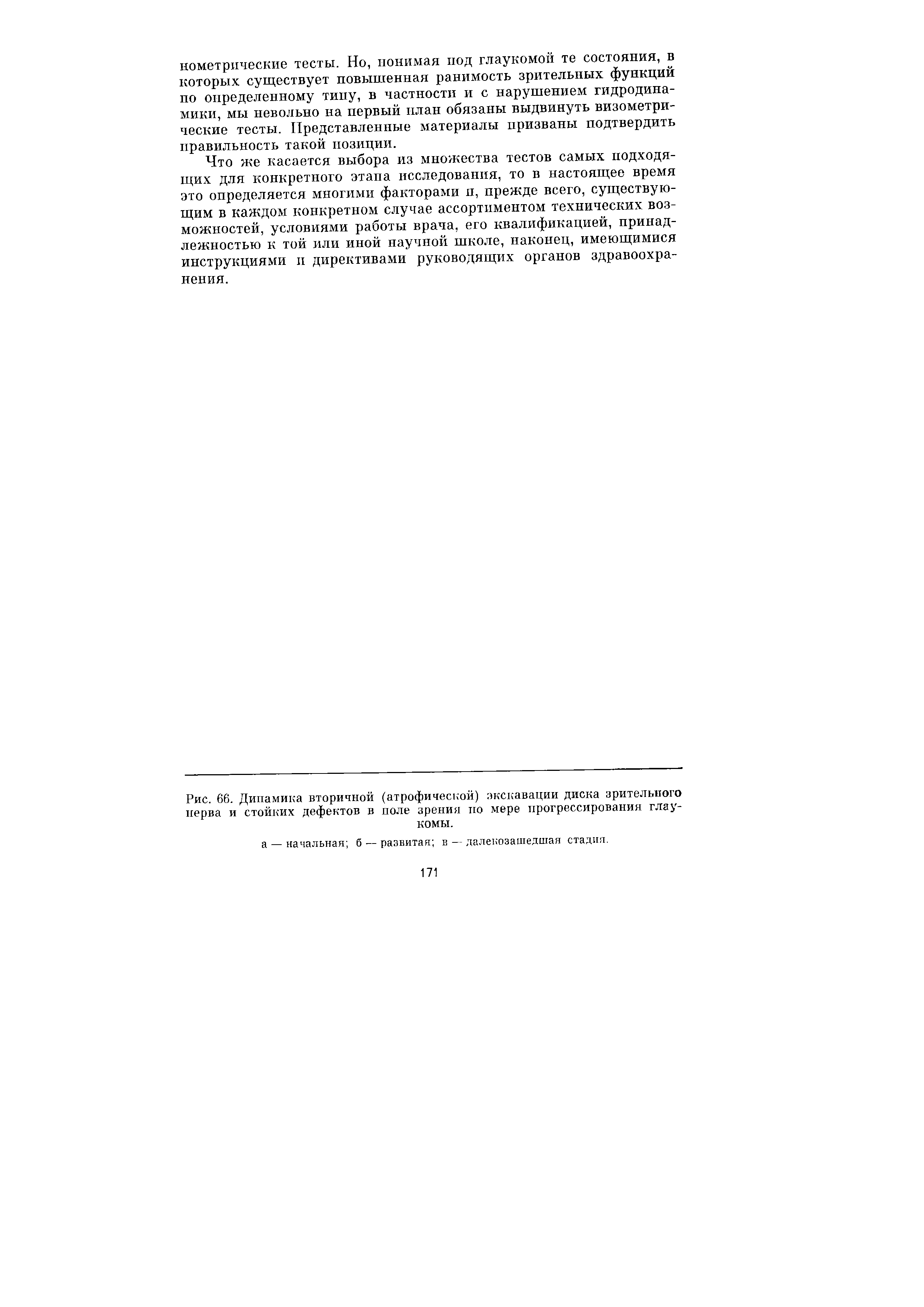 Рис. 66. Динамика вторичной (атрофической) экскавации диска зрительного нерва и стойких дефектов в поле зрения по мере прогрессирования глаукомы.