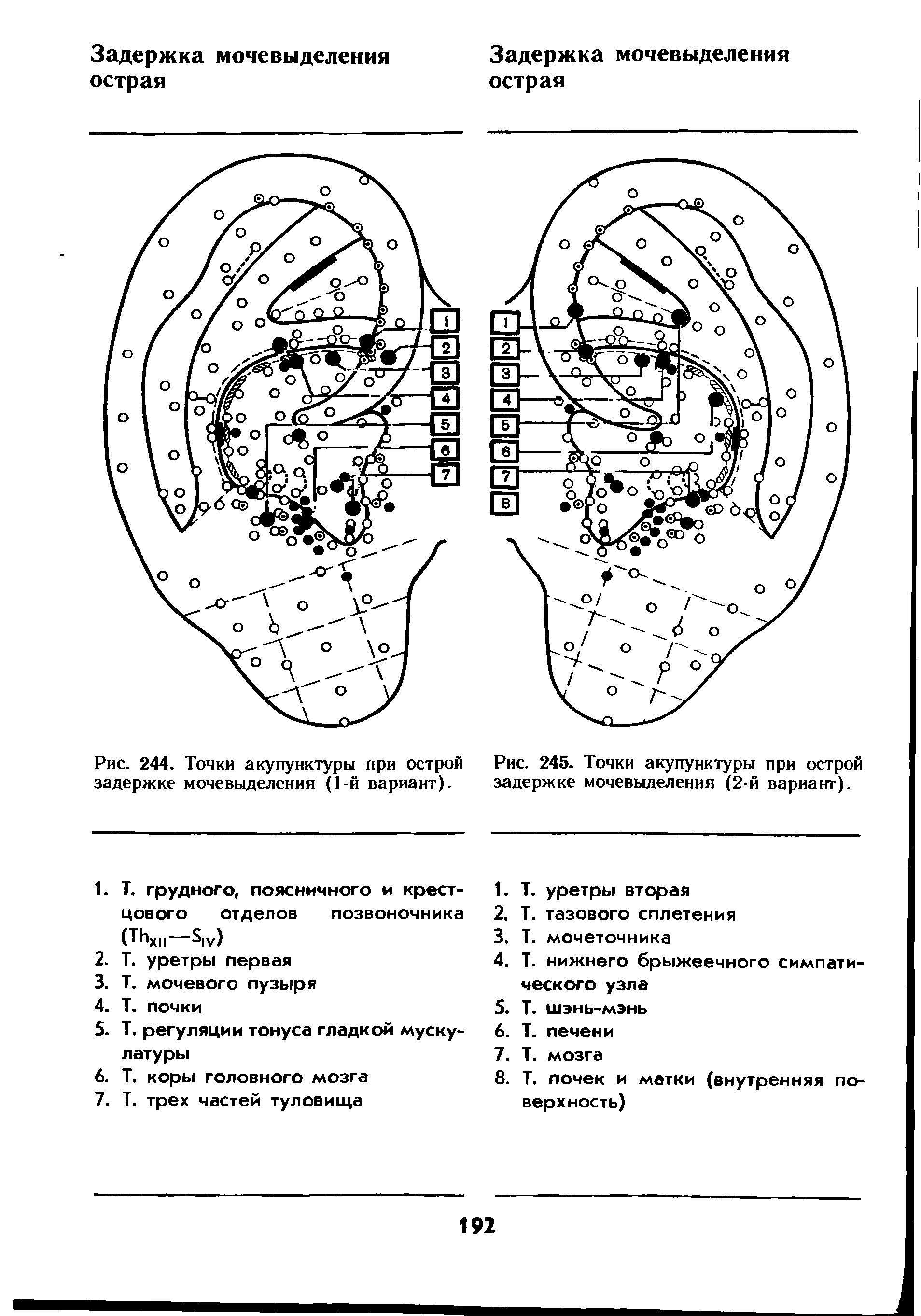 Рис. 244. Точки акупунктуры при острой задержке мочевыделения (1-й вариант).