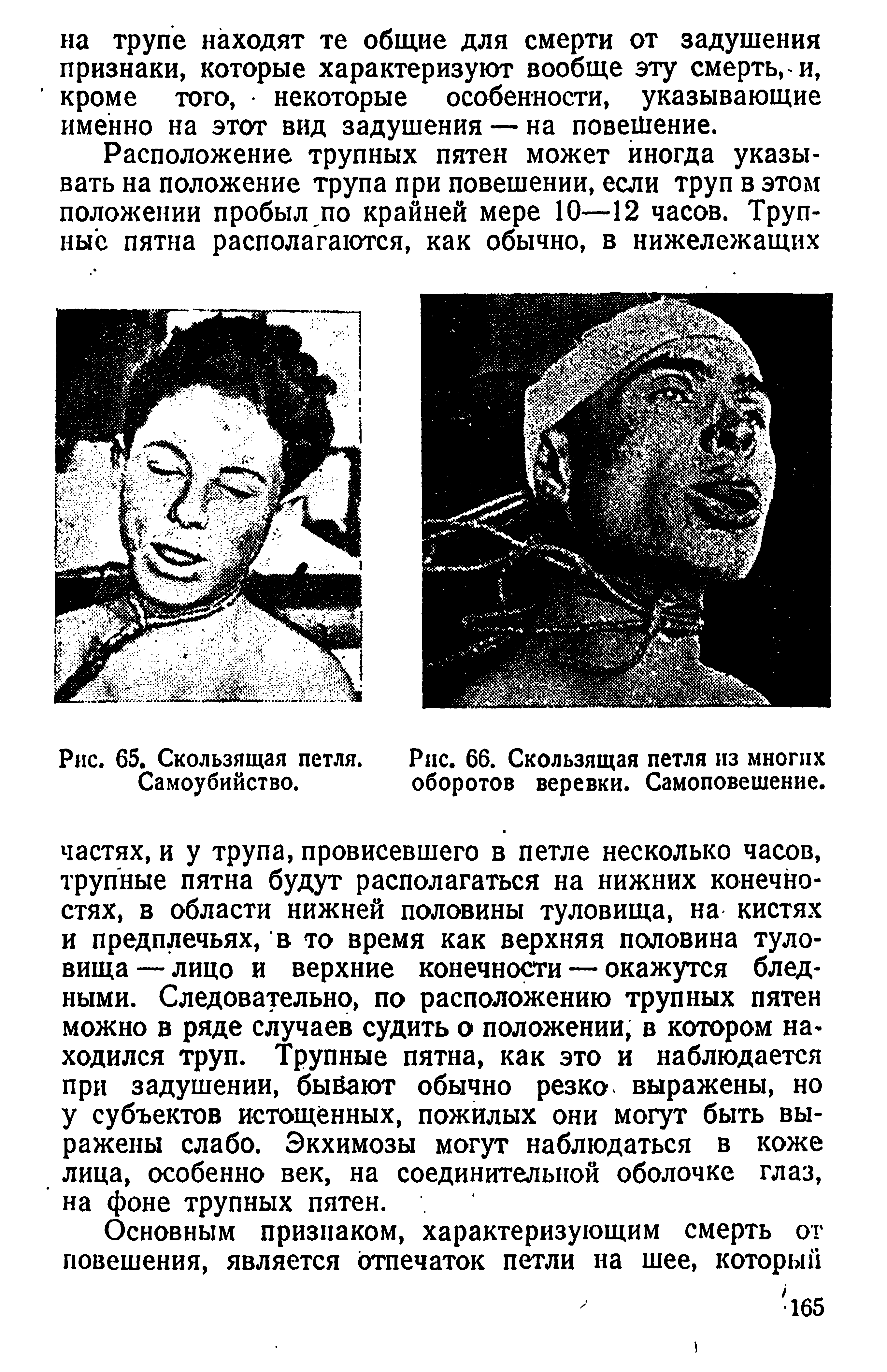 Рис. 66. Скользящая петля из многих оборотов веревки. Самоповешение.