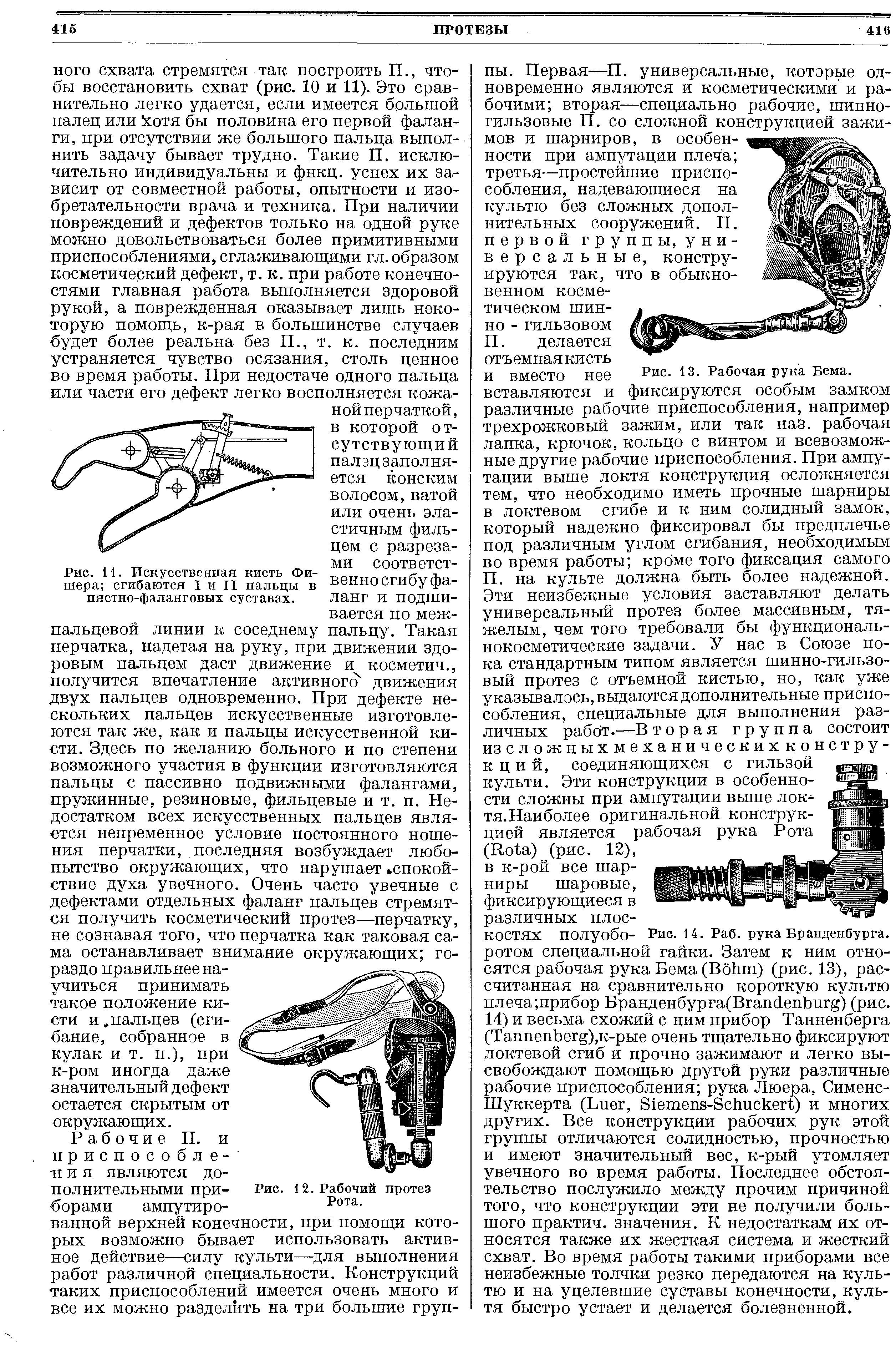 Рис. 11. Искусственная кисть Фишера сгибаются I и II пальцы в пястно-фаланговых суставах.