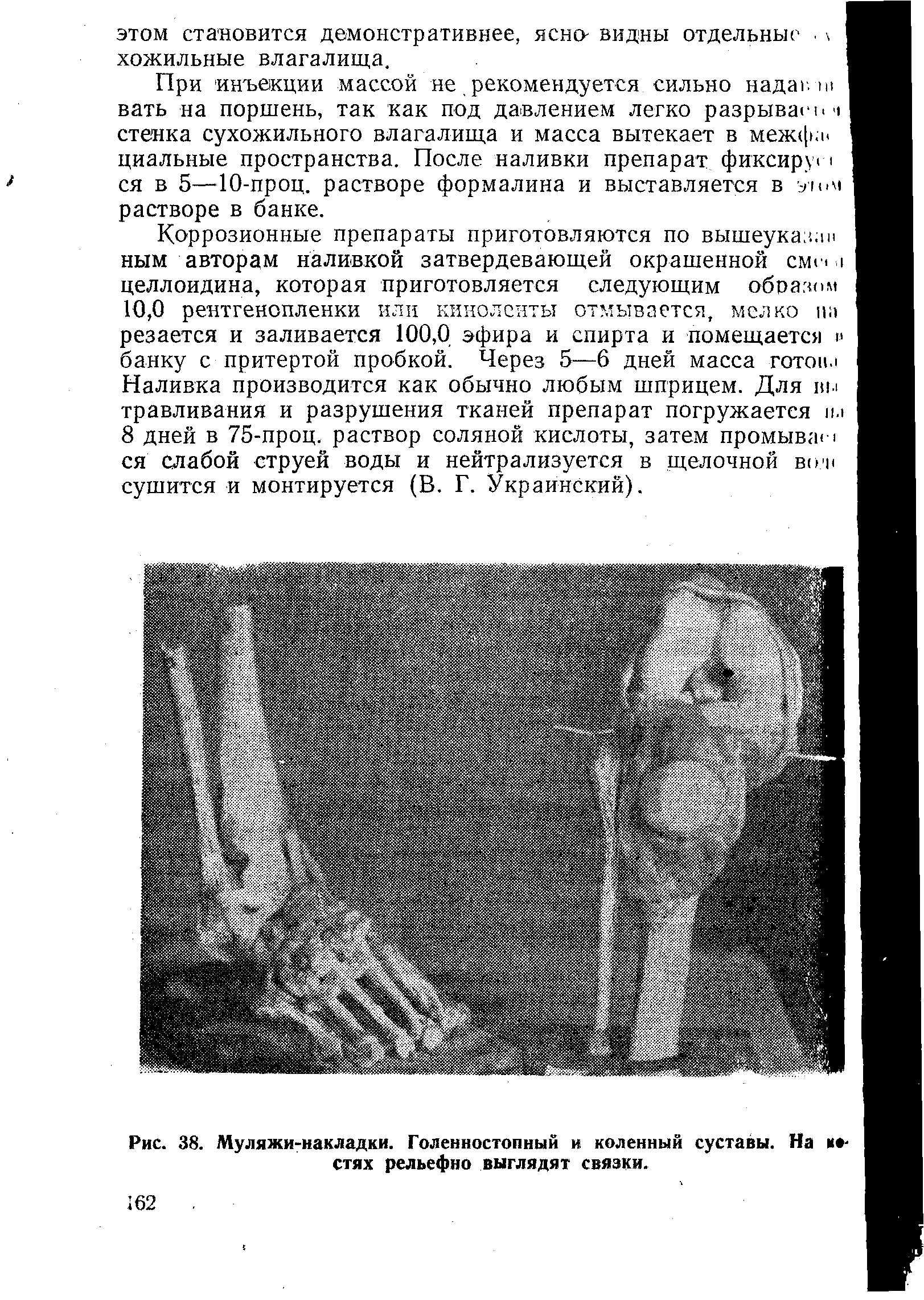 Рис. 38. Муляжи-накладки. Голенностопный и коленный суставы. На и стях рельефно выглядят связки.