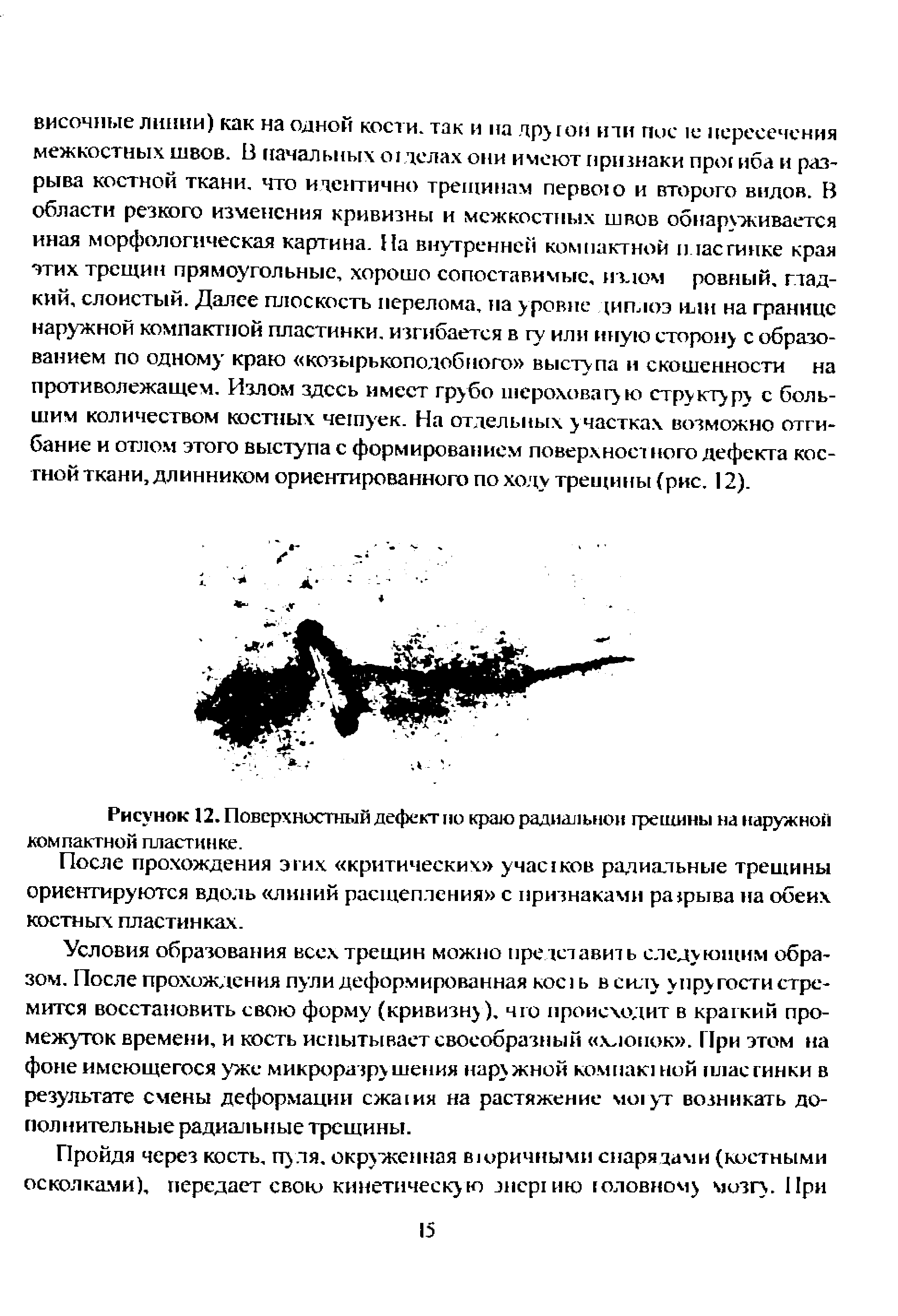 Рисунок 12. Поверхностный дефектно краю радиальной трещины на наружной компактной пластинке.