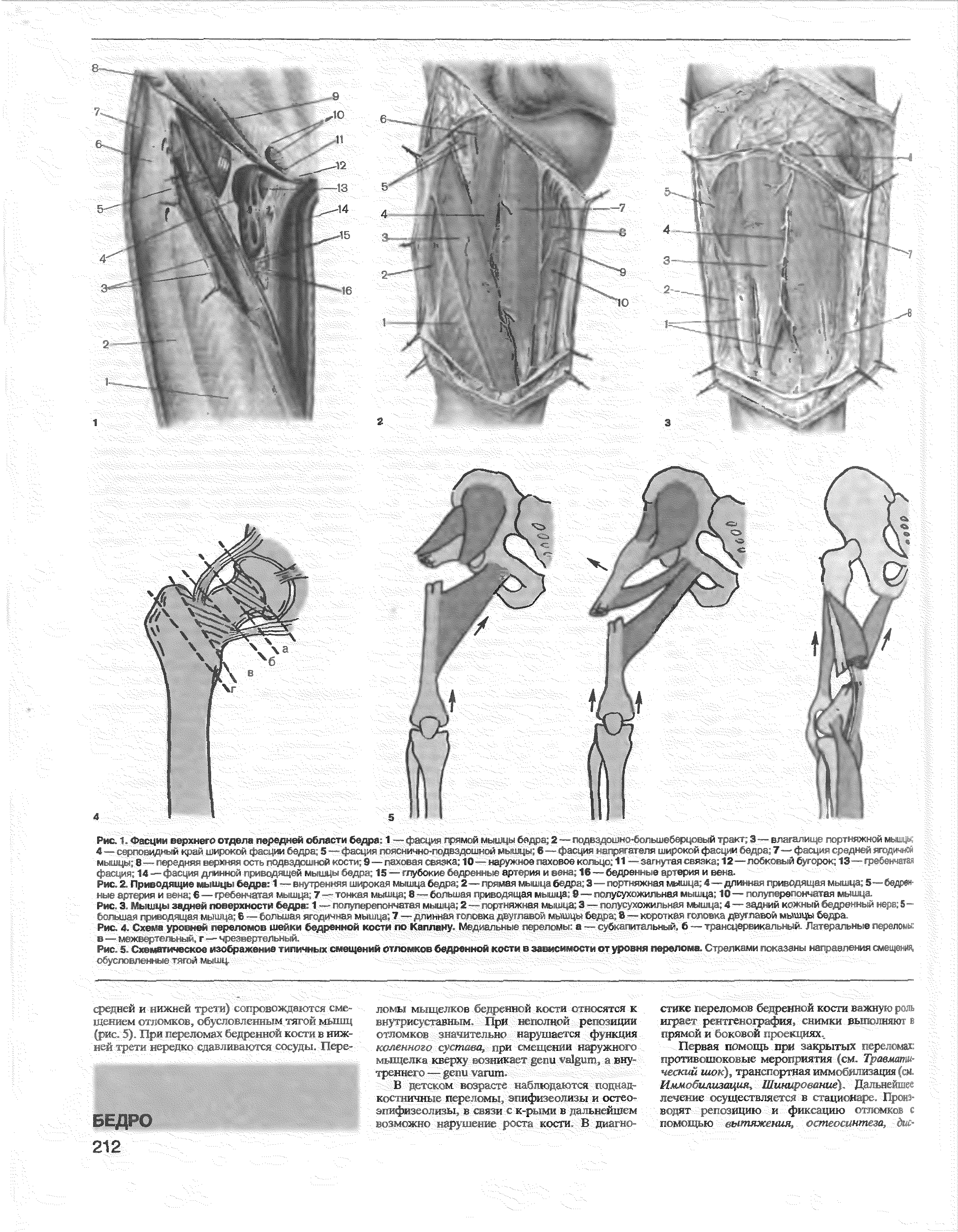 Рис. 2. Приводящие мышцы бедра 1 — внутренняя широкая мышца бедра 2—прямая мышца бедра 3—портняжная мышца 4—длинная приводящая мышца 5—бедренные артерия и вена 6—гребенчатая мышца- 7 — тонкая мышца 8-—большая приводящая мышца 8— полусуэсожильная мышца 10 — полу перепончатая мышца.