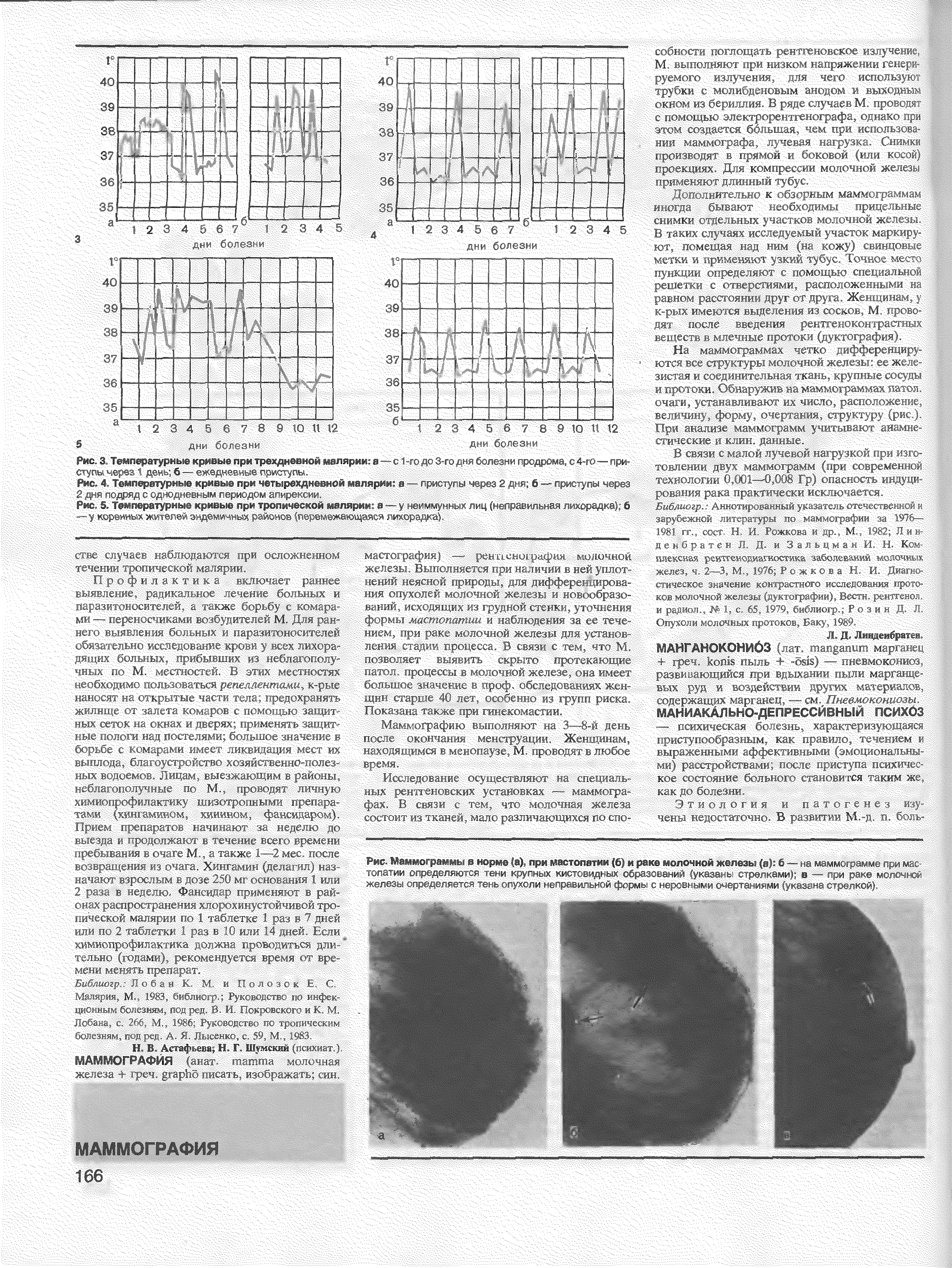 Рис. 5. Температурные кривые при тропической малярии я — у неиммунных лиц (неправильная лихорадка) б...