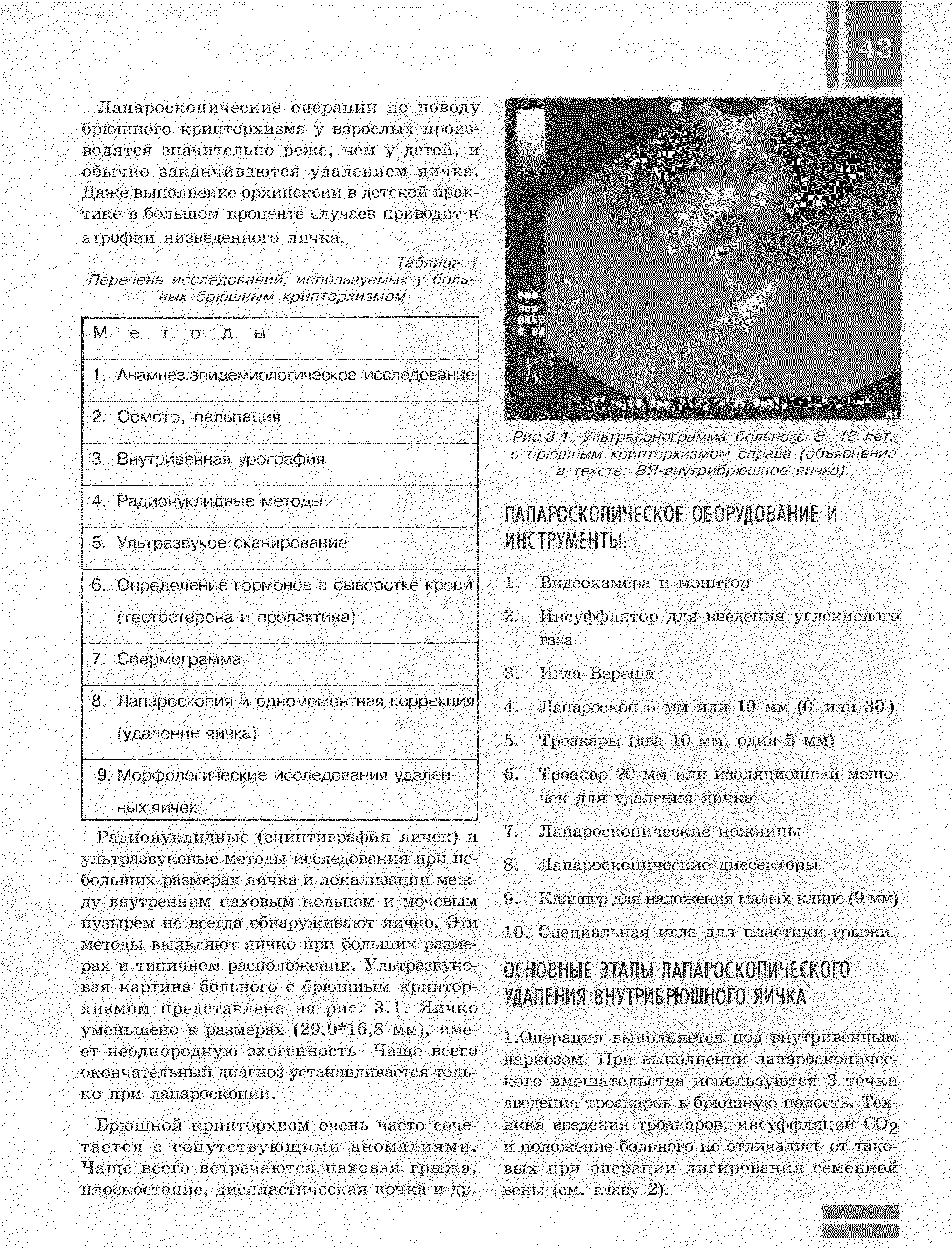 Рис.3.1. Ультрасонограмма больного 3. 18 лет, с брюшным крипторхизмом справа (объяснение в тексте ВЯ-внутрибрюшное яичко).