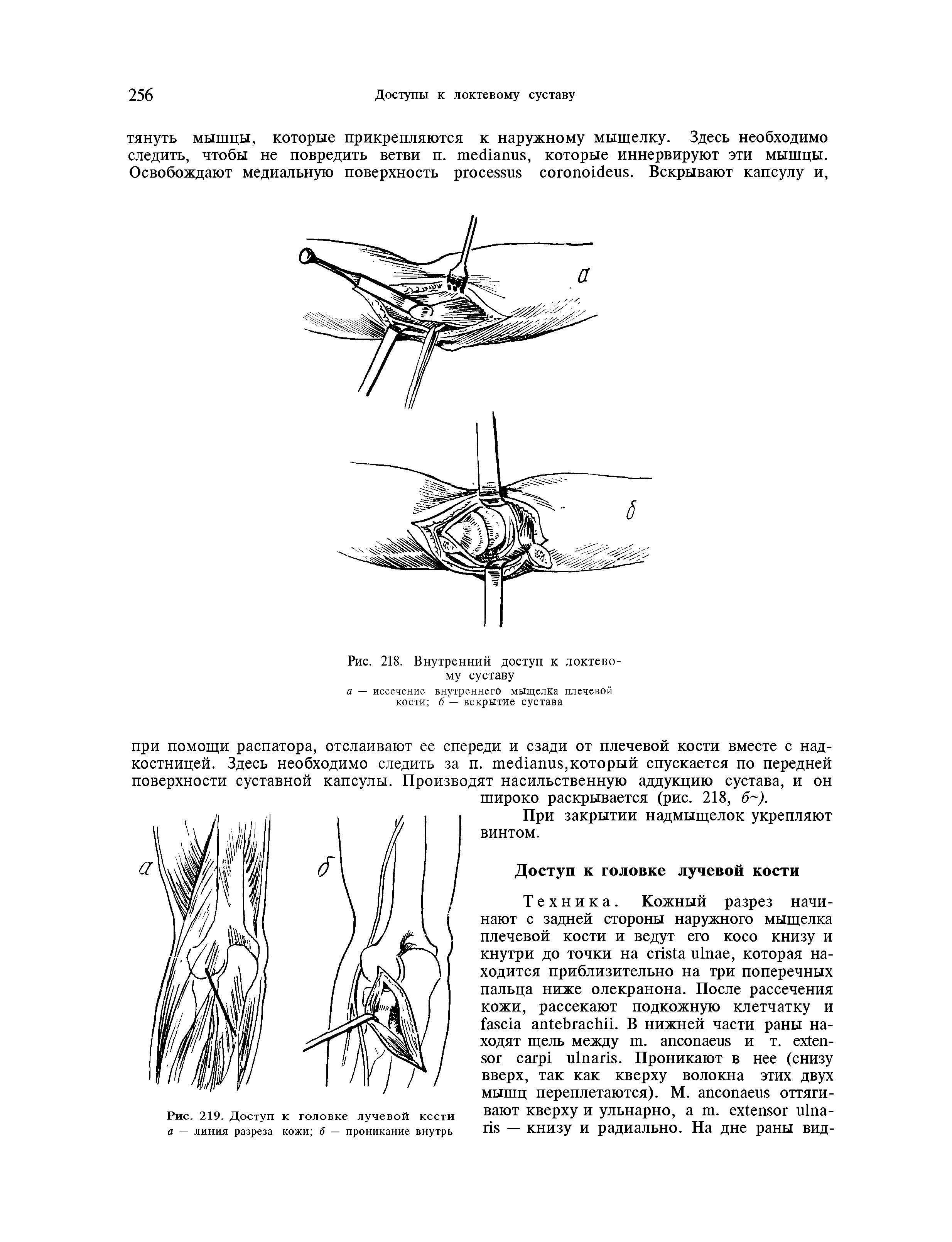 Рис. 219. Доступ к головке лучевой кссти а — линия разреза кожи б — проникание внутрь...