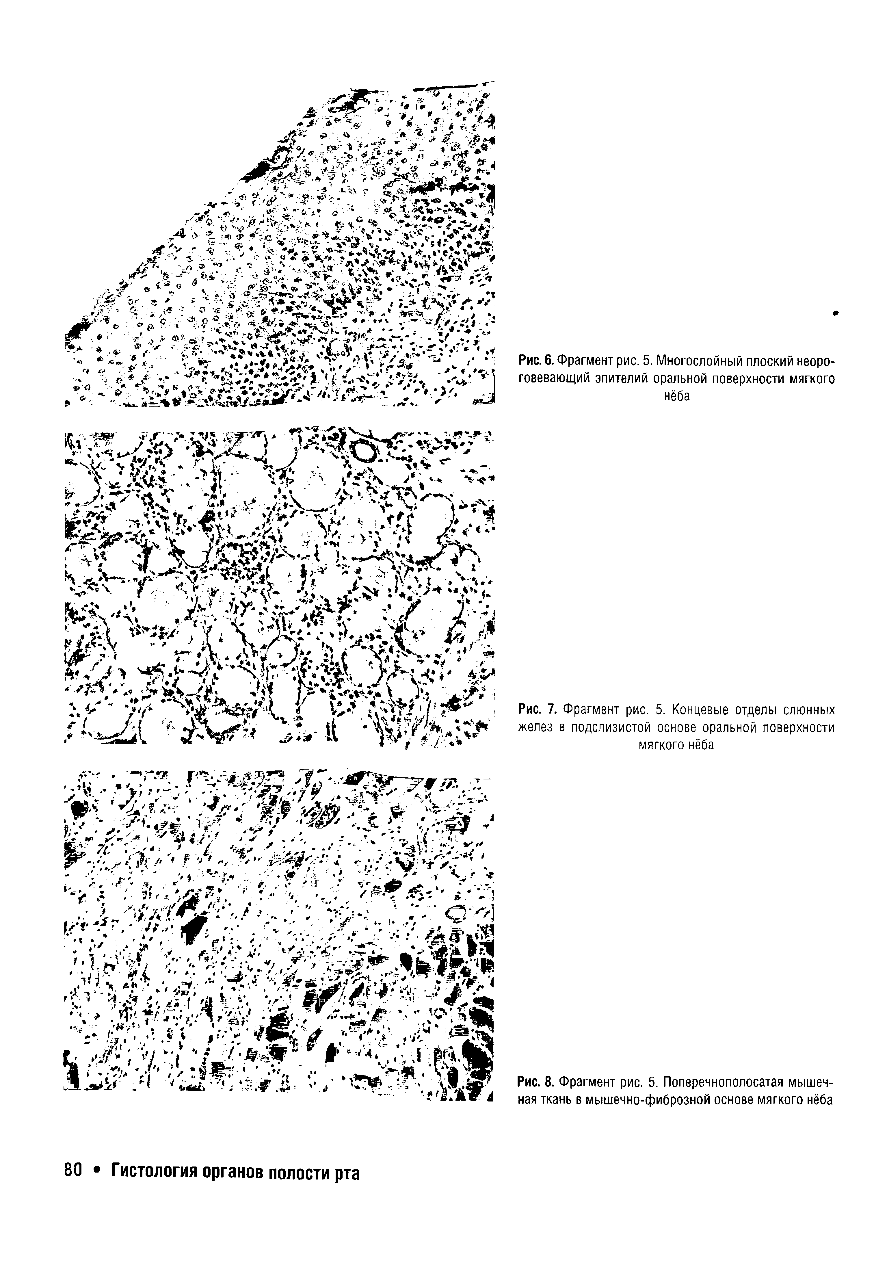 Рис. 7. Фрагмент рис. 5. Концевые отделы слюнных желез в подслизистой основе оральной поверхности мягкого нёба...