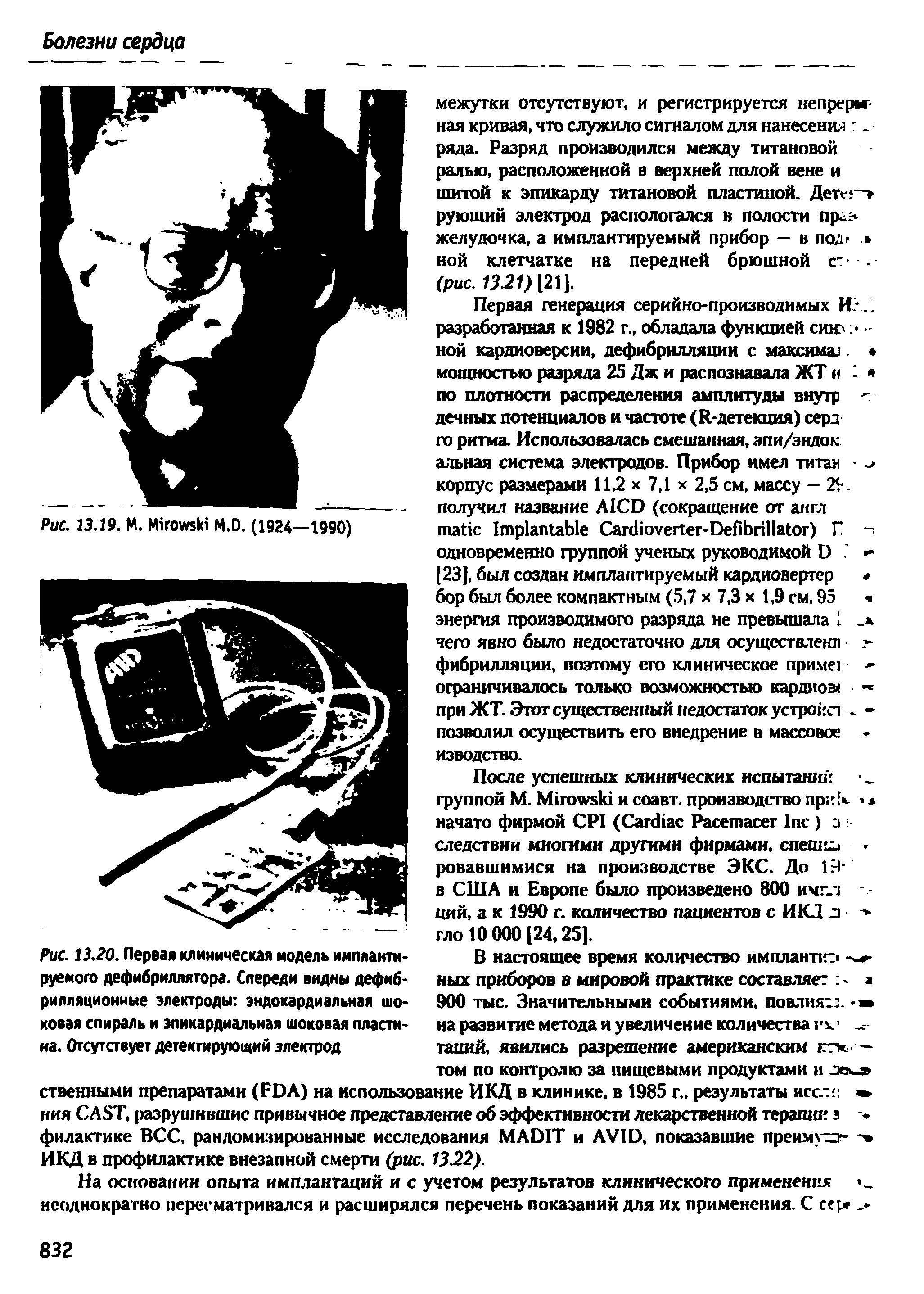 Рис. 13.20. Первая клиническая модель имплантируемого дефибриллятора. Спереди видны дефиб-рилляциоииые электроды эндокардиальная шоковая спираль и эпикардиальная шоковая пластина. Отсутствует детектирующий электрод...