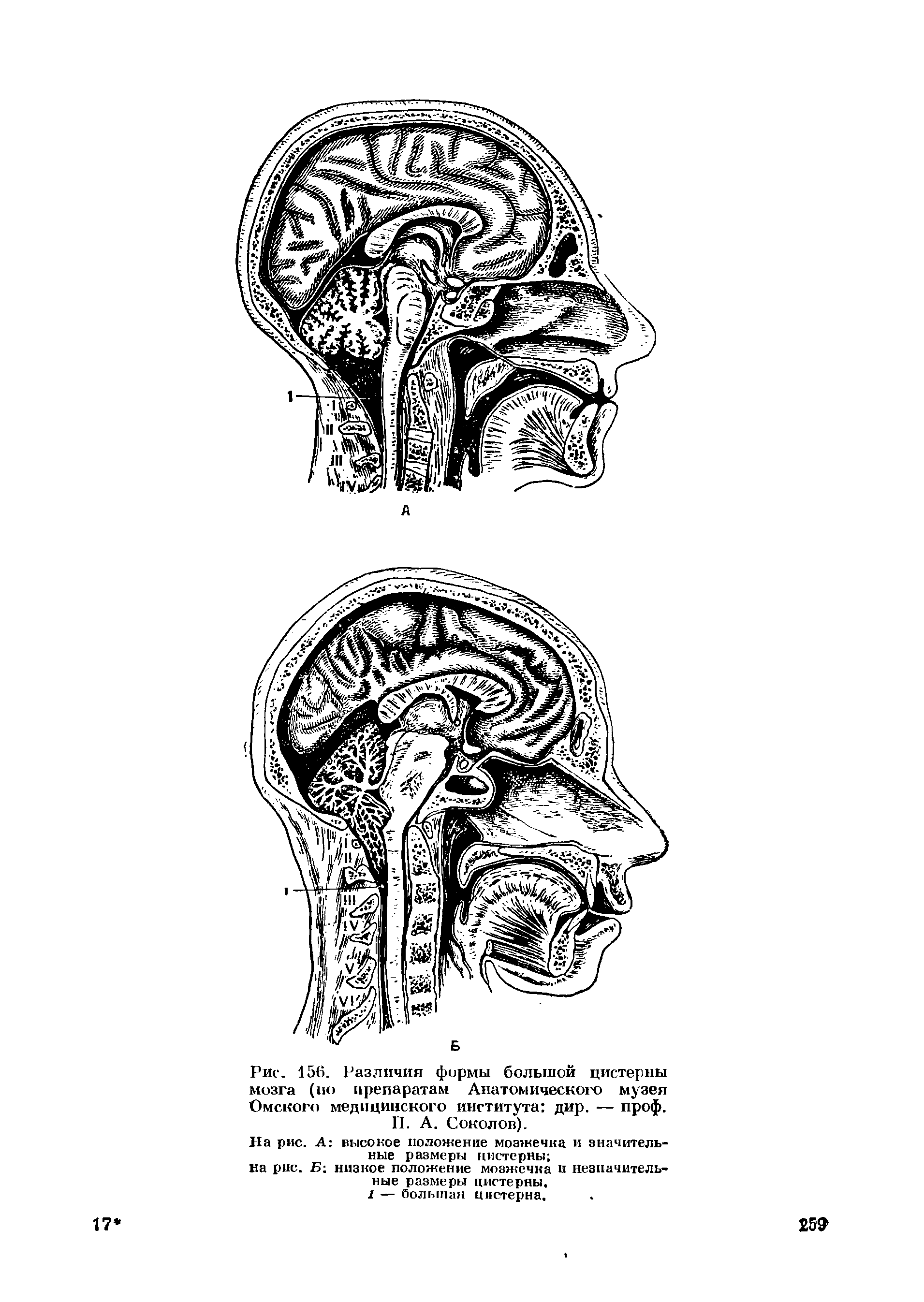 Рис. 156. Различия фирмы большой цистерны мозга (ио препаратам Анатомического музея Омского медицинского института дир. — проф. П. А. Соколов).