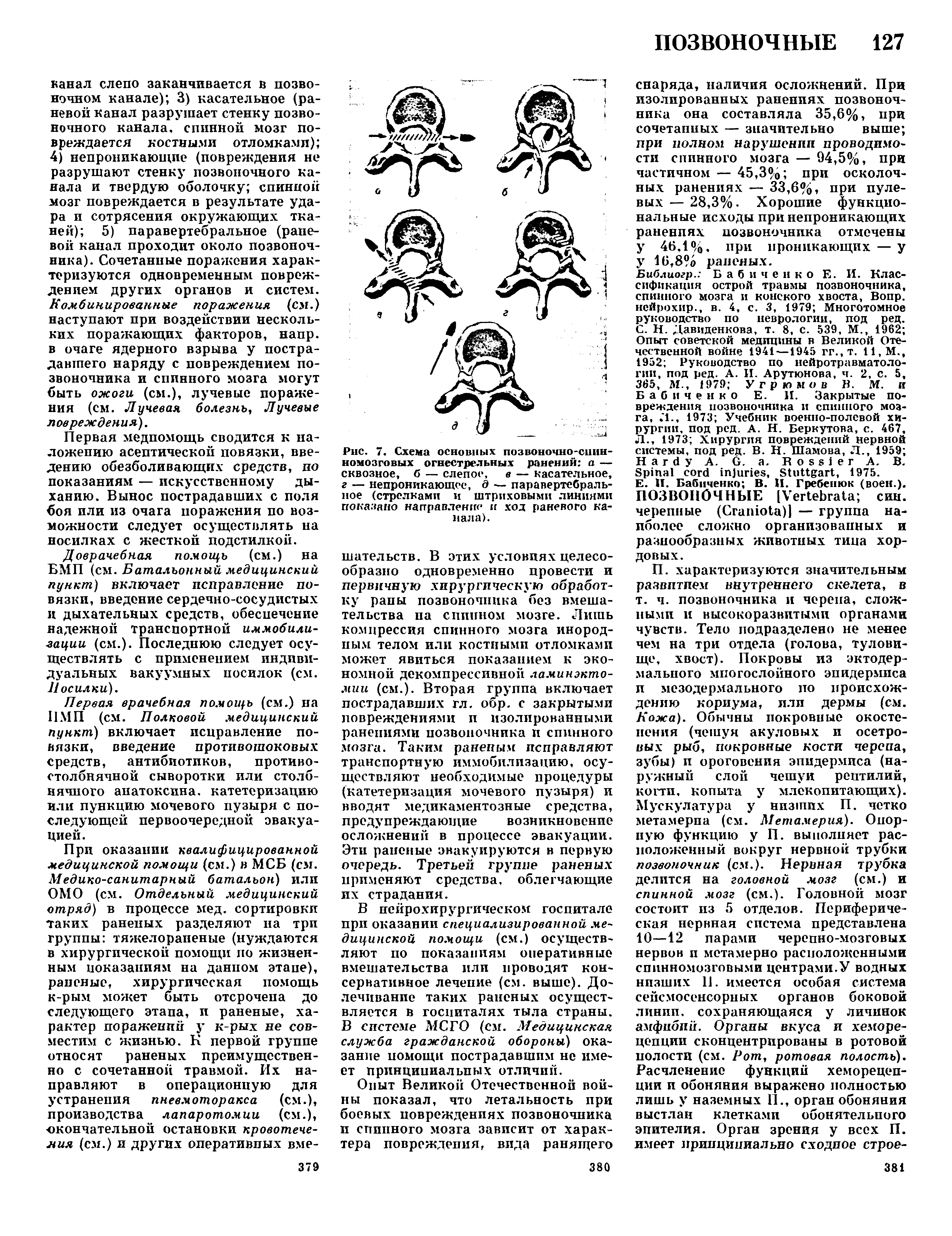 Рис. 7. Схема основных позвоночно-спинномозговых огнестрельных ранений а — сквозное, б — слепое, в — касательное, г — непроникающое, д — паравертебральное (стрелками и штриховыми линиями показано направление и ход раневого канала).