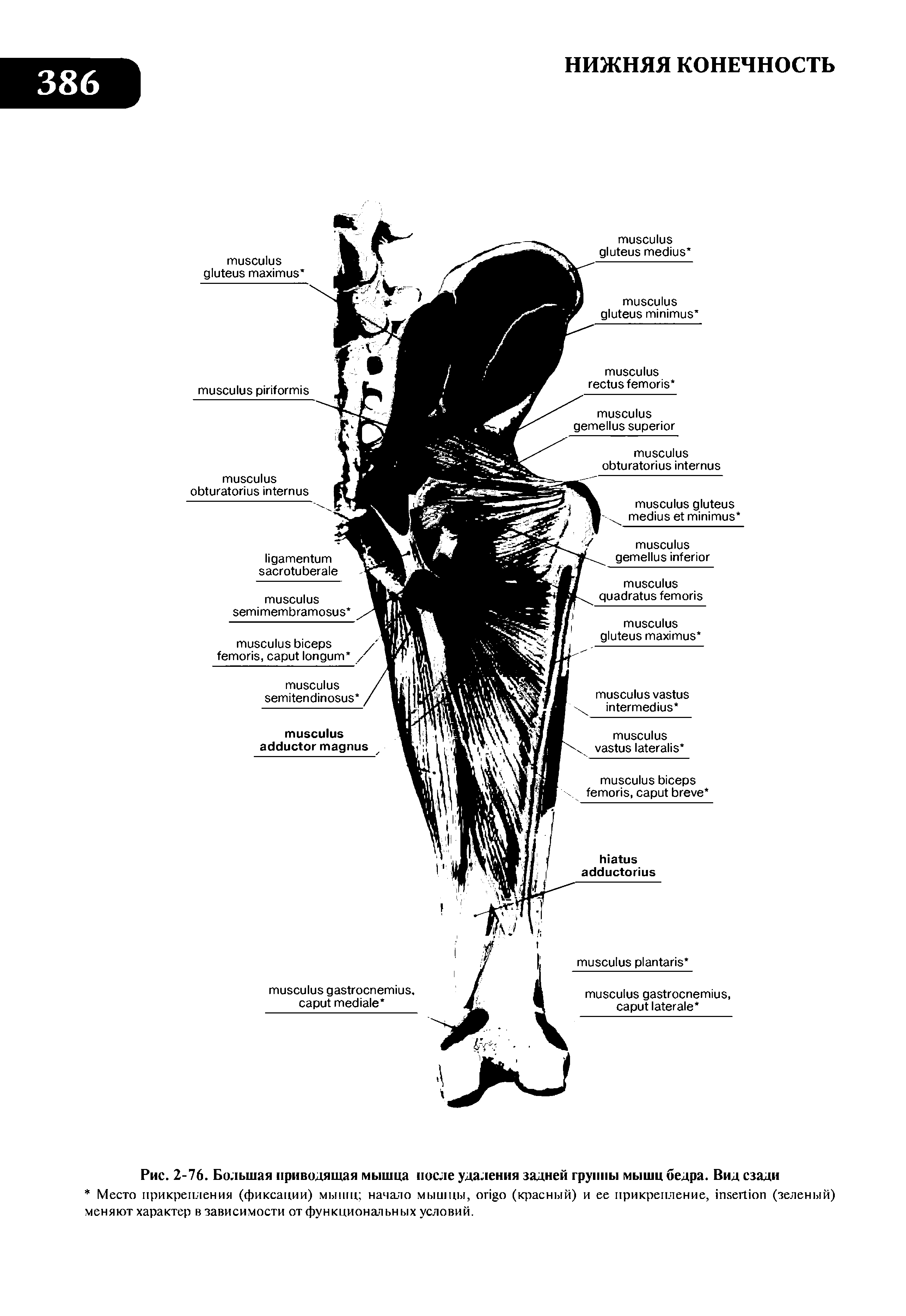 Рис. 2-76. Большая приводящая мышца после удаления задней группы мышц бедра. Вид сзади...