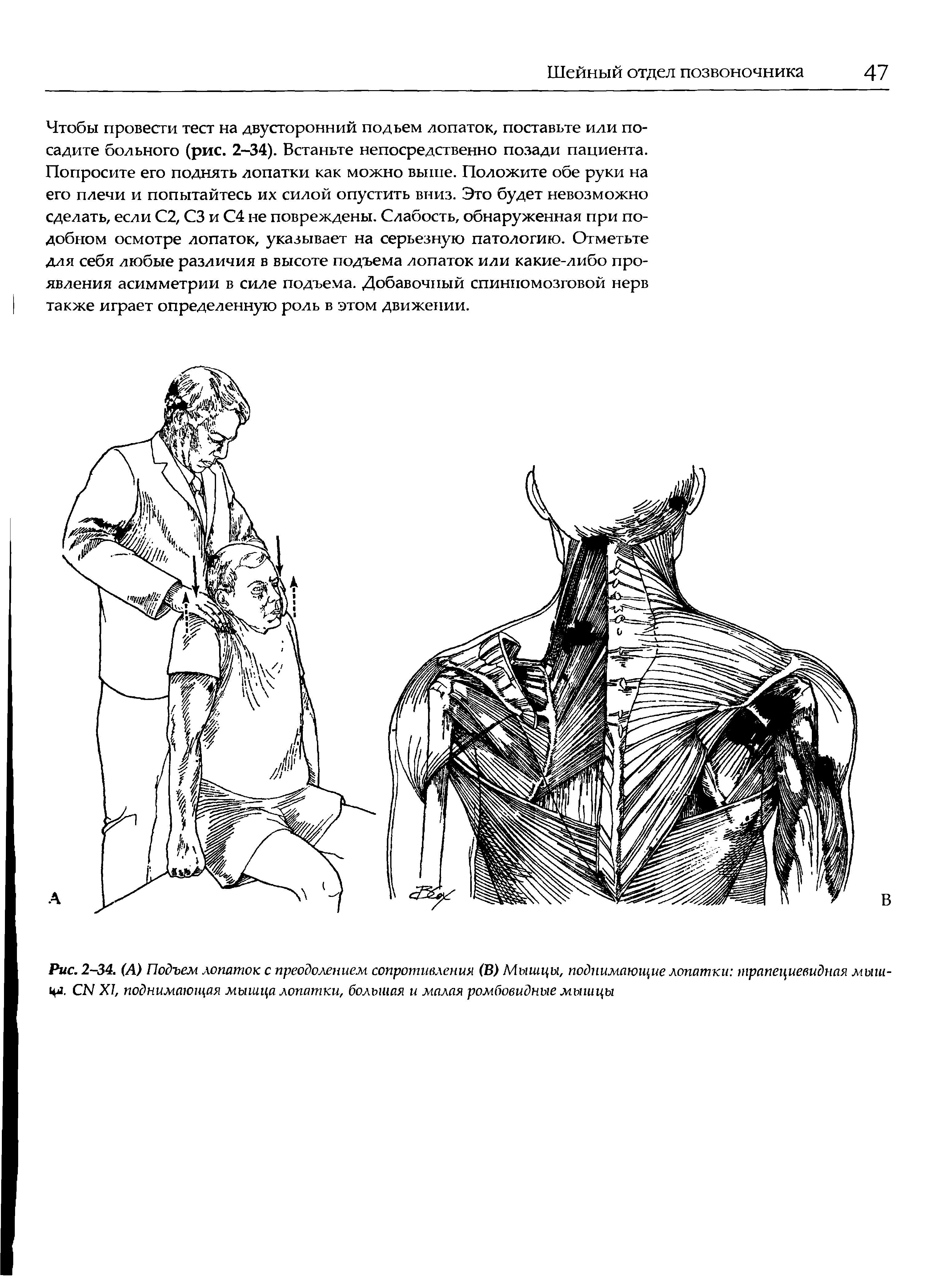 Рис. 2-34. (А) Подъем лопаток с преодолением сопротивления (В) Мышцы, поднимающие лопатки трапециевидная мышца. СМ XI, поднимающая мышца лопатки, большая и малая ромбовидные мышцы...