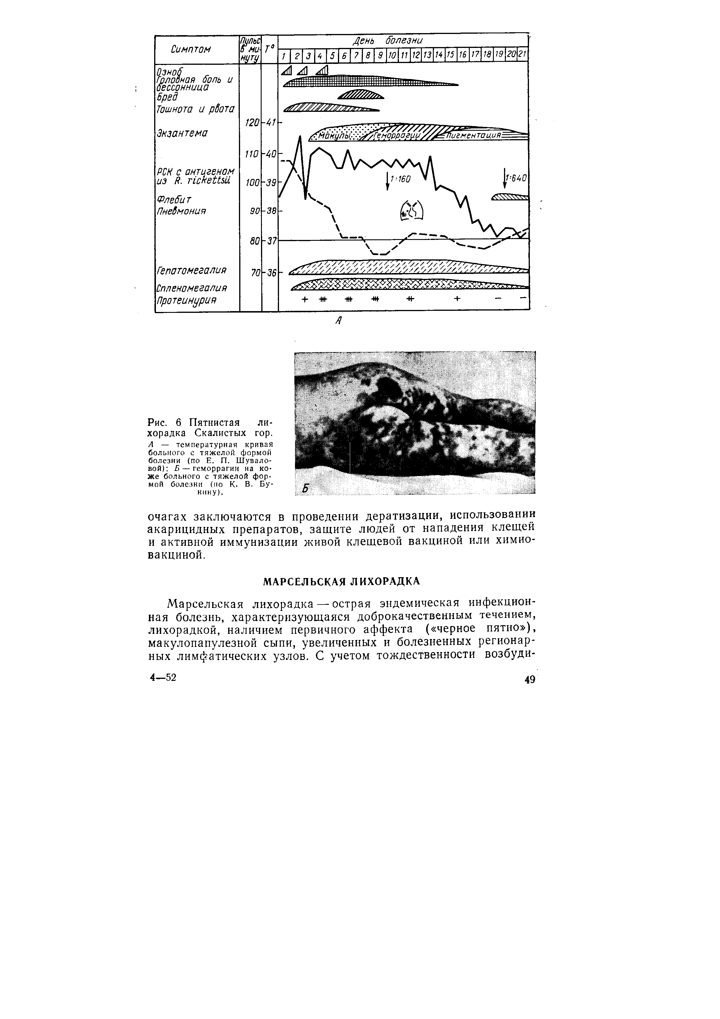 Рис. 6 Пятнистая лихорадка Скалистых гор. А — температурная кривая больного с тяжелой формой болезни (по Е. П. Шуваловой) Б — геморрагии на коже больного с тяжелой формой болезни (по К. В. Бунину).