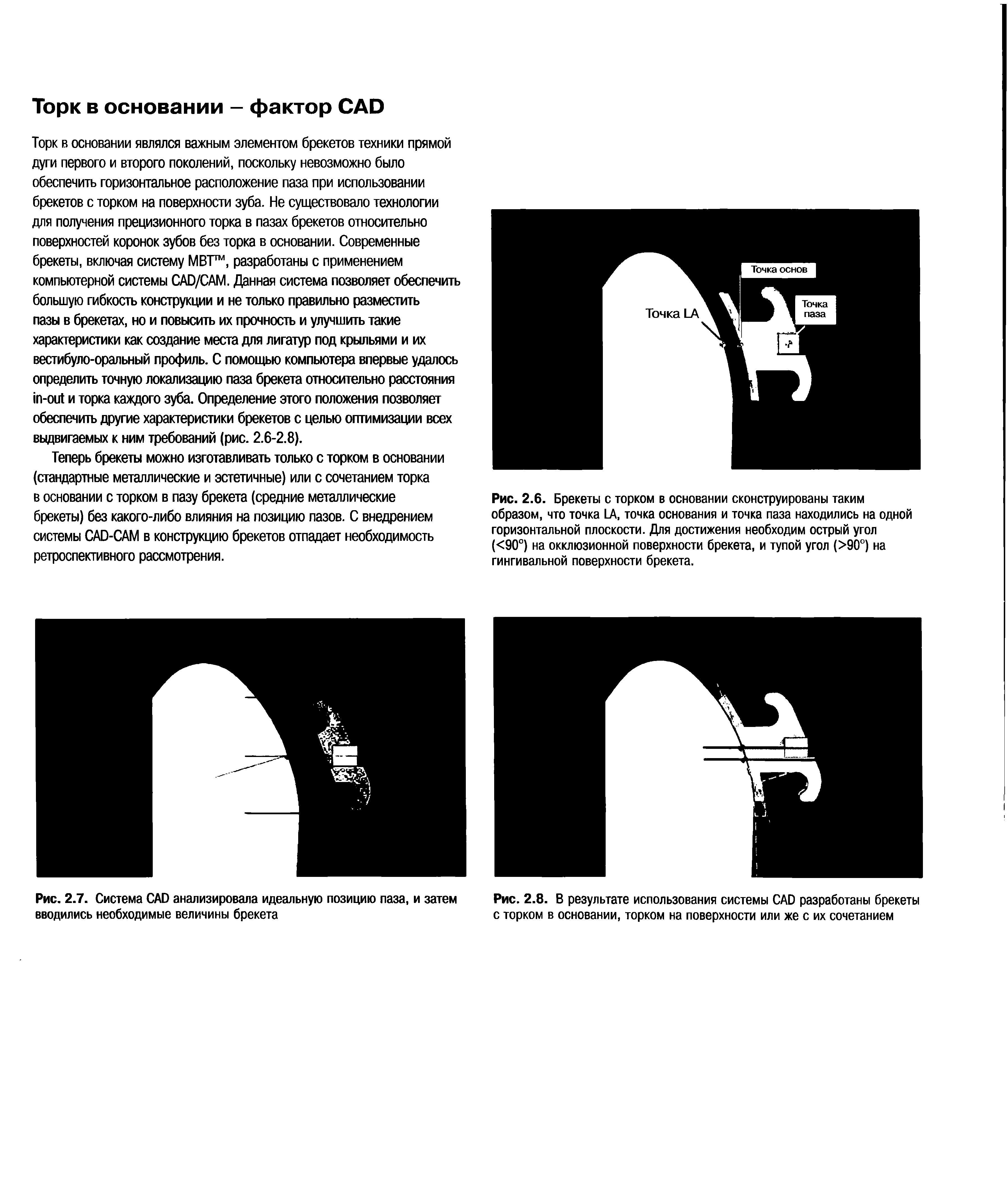 Рис. 2.6. Брекеты с торком в основании сконструированы таким образом, что точка ЬА, точка основания и точка паза находились на одной горизонтальной плоскости. Для достижения необходим острый угол (<90°) на окклюзионной поверхности брекета, и тупой угол (>90°) на гингивальной поверхности брекета.