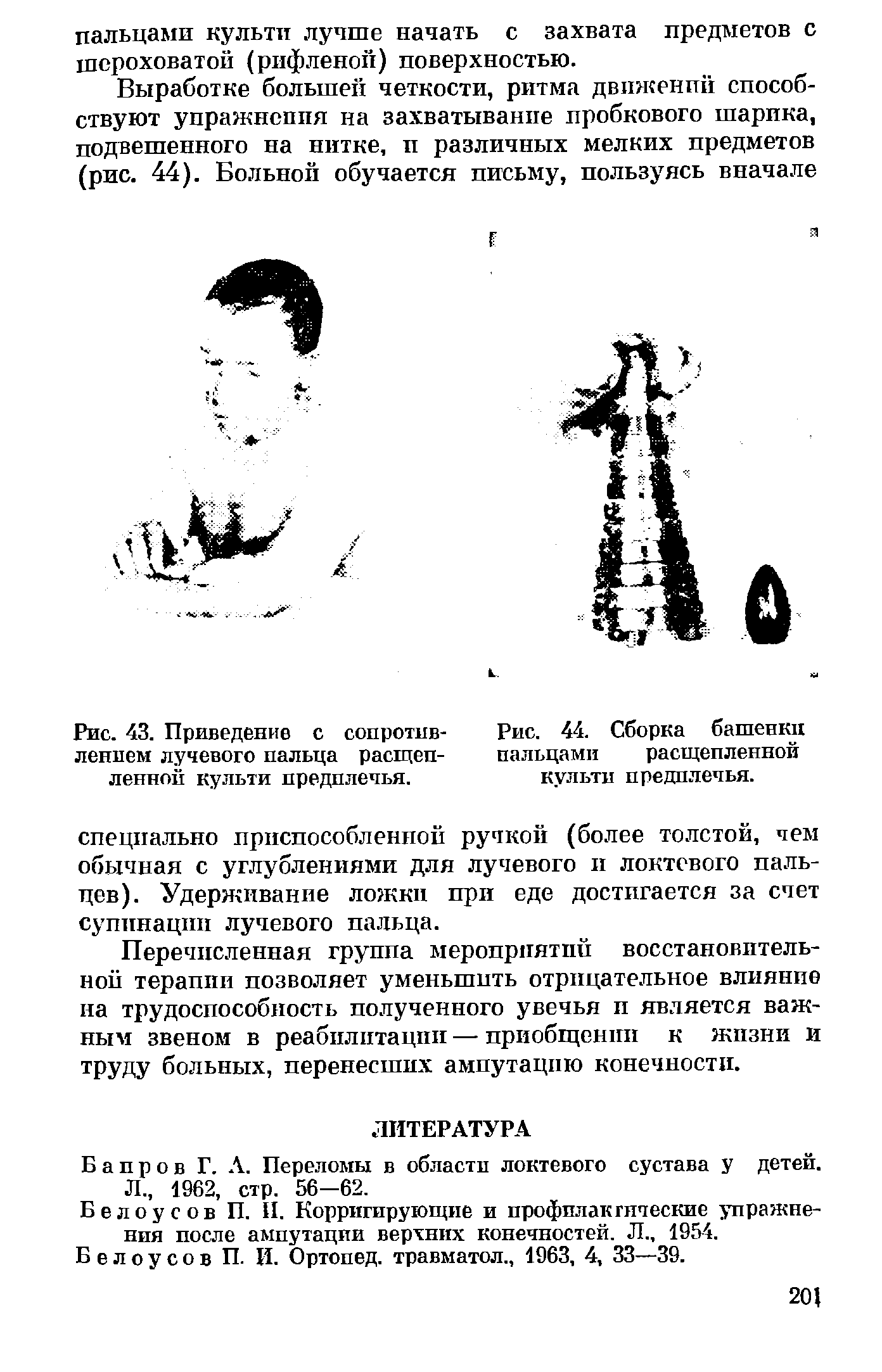 Рис. 43. Приведение с сопротивлением лучевого пальца расщепленной культи предплечья.