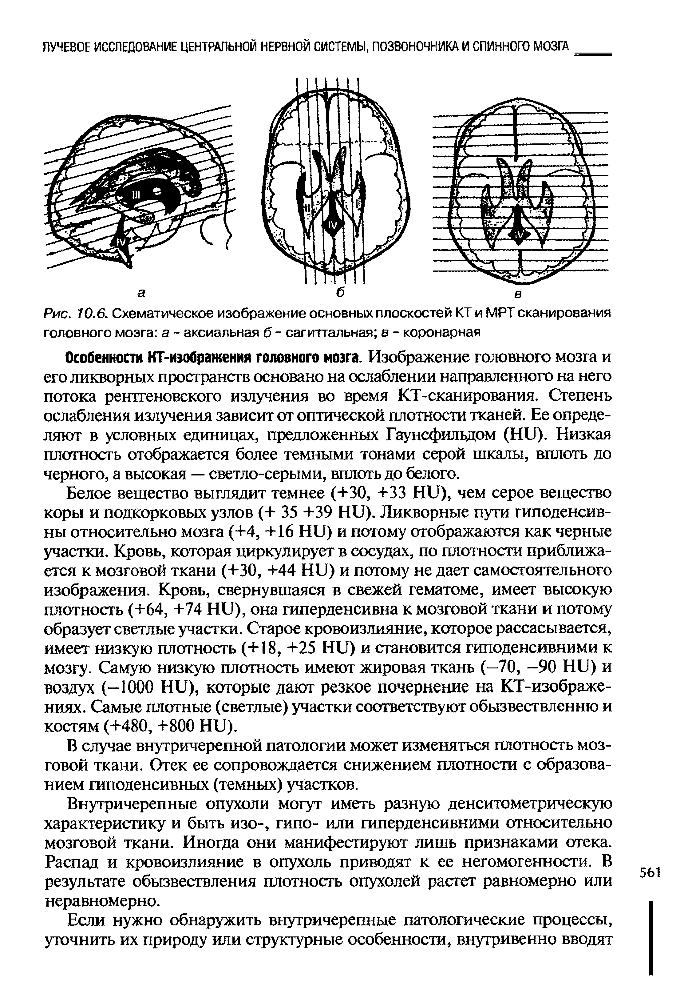 Рис. 10.6. Схематическое изображение основных плоскостей КТ и МРТ сканирования головного мозга а - аксиальная б - сагиттальная в - коронарная...