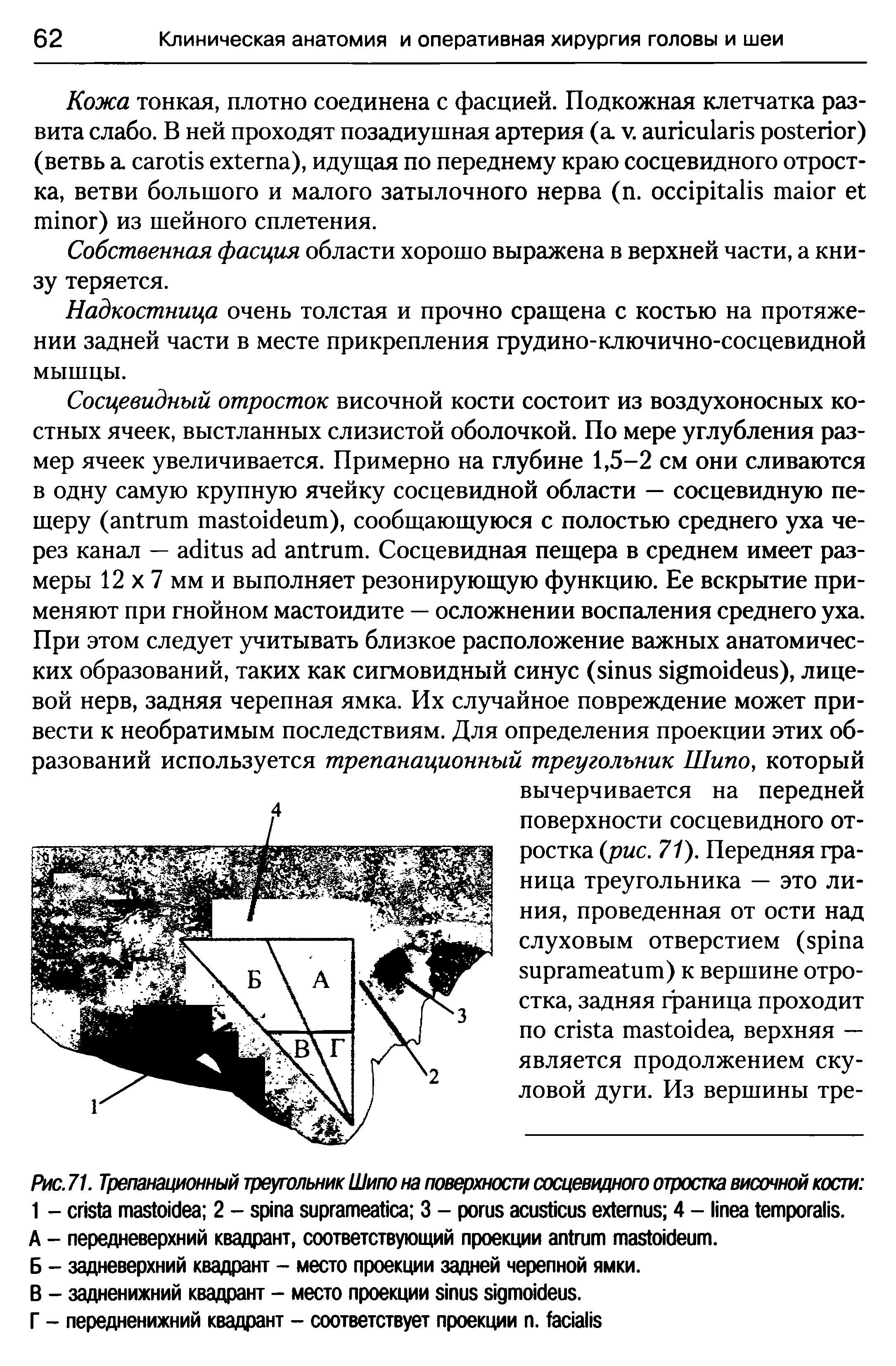 Рис.71. Трепанационный треугольникШипона поверхности сосцевидного отростка височной кости 1 - 2 - 3 - 4 - . A - передневерхний квадрант, соответствующий проекции .