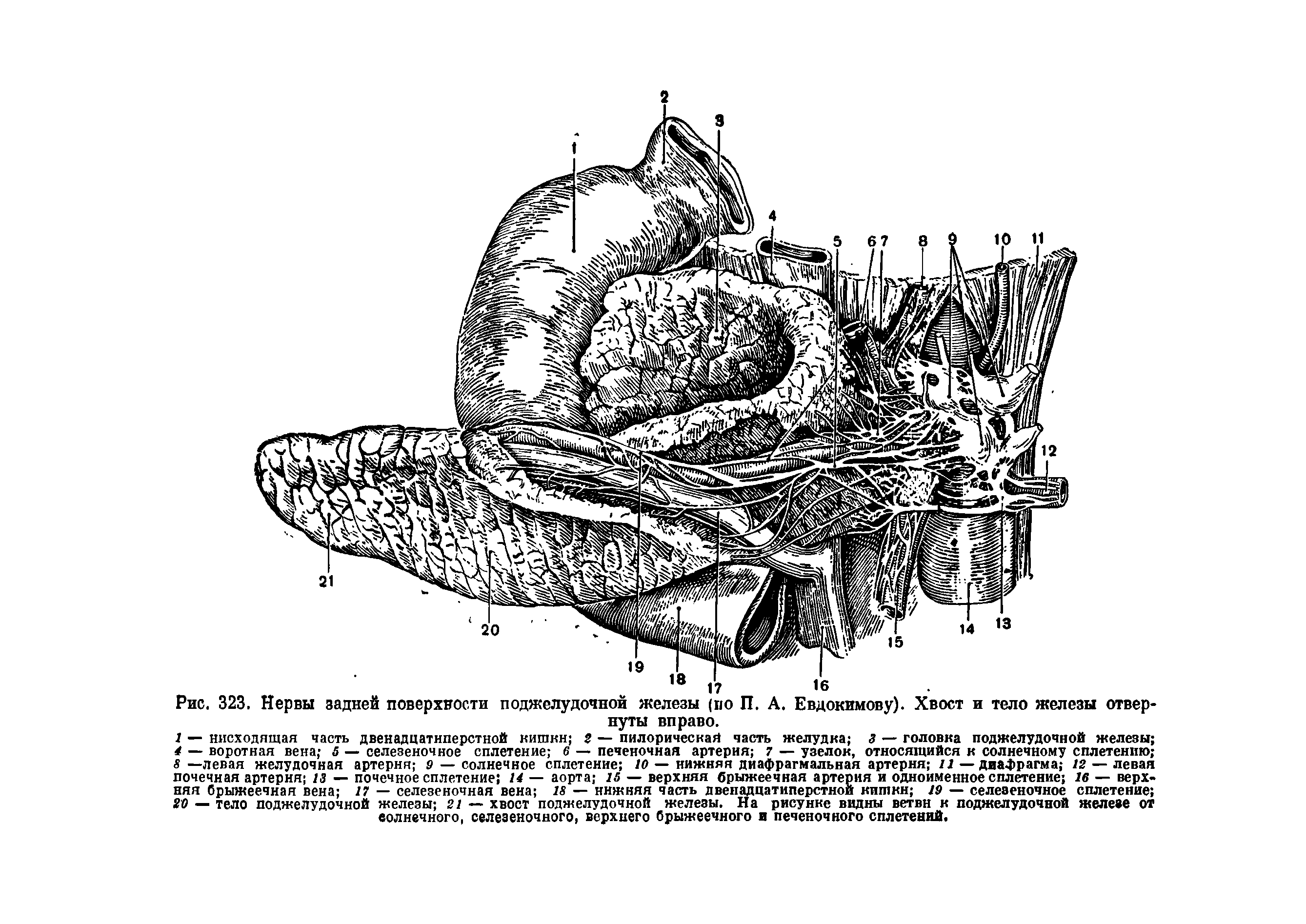 Рис. 323. Нервы задней поверхности поджелудочной железы (по П. А. Евдокимову). Хвост и тело железы отвернуты вправо.