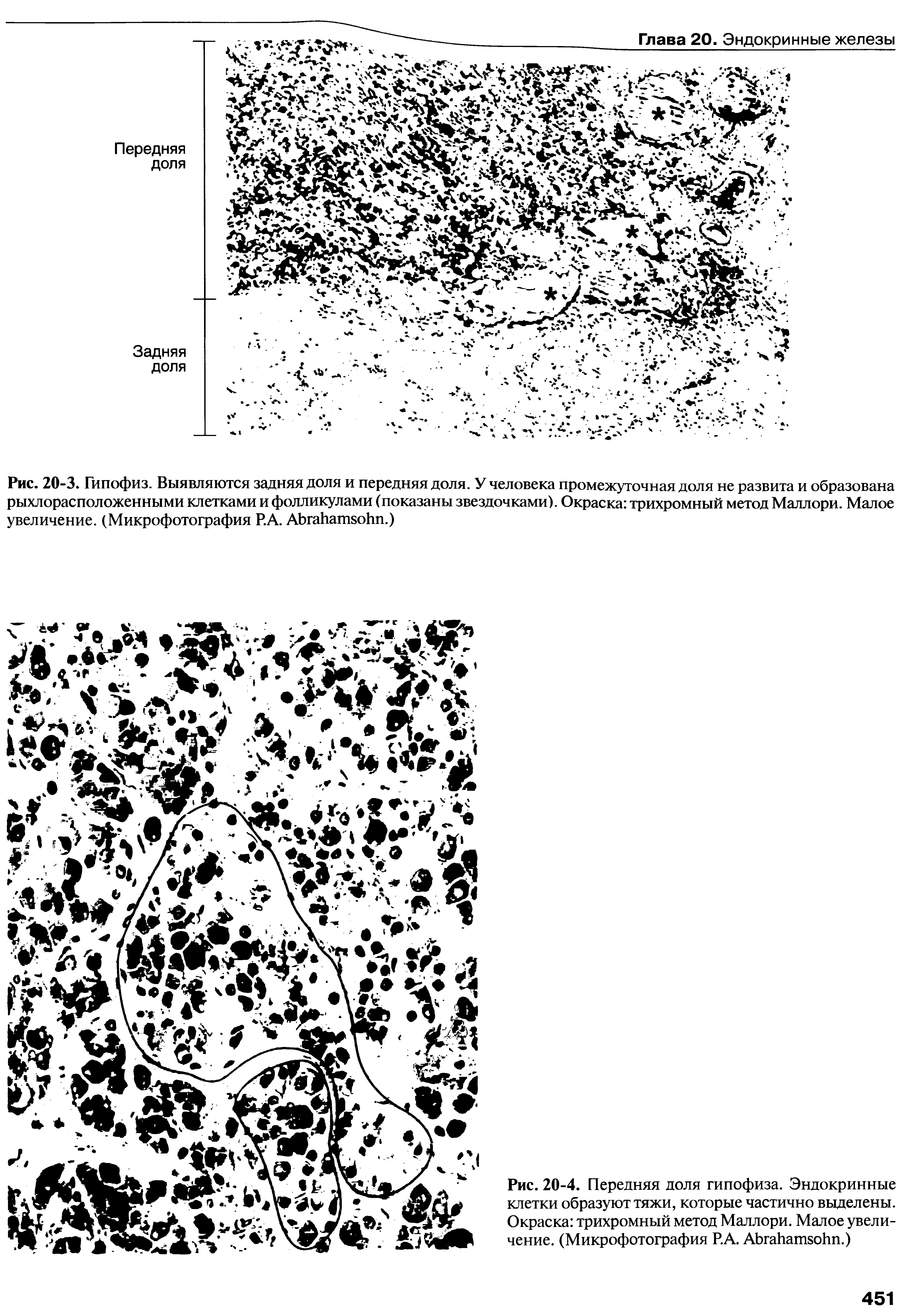 Рис. 20-3. Гипофиз. Выявляются задняя доля и передняя доля. У человека промежуточная доля не развита и образована рыхлорасположенными клетками и фолликулами (показаны звездочками). Окраска трихромный метод Маллори. Малое увеличение. (Микрофотография Р.А. АЪгаИатзоИп.)...