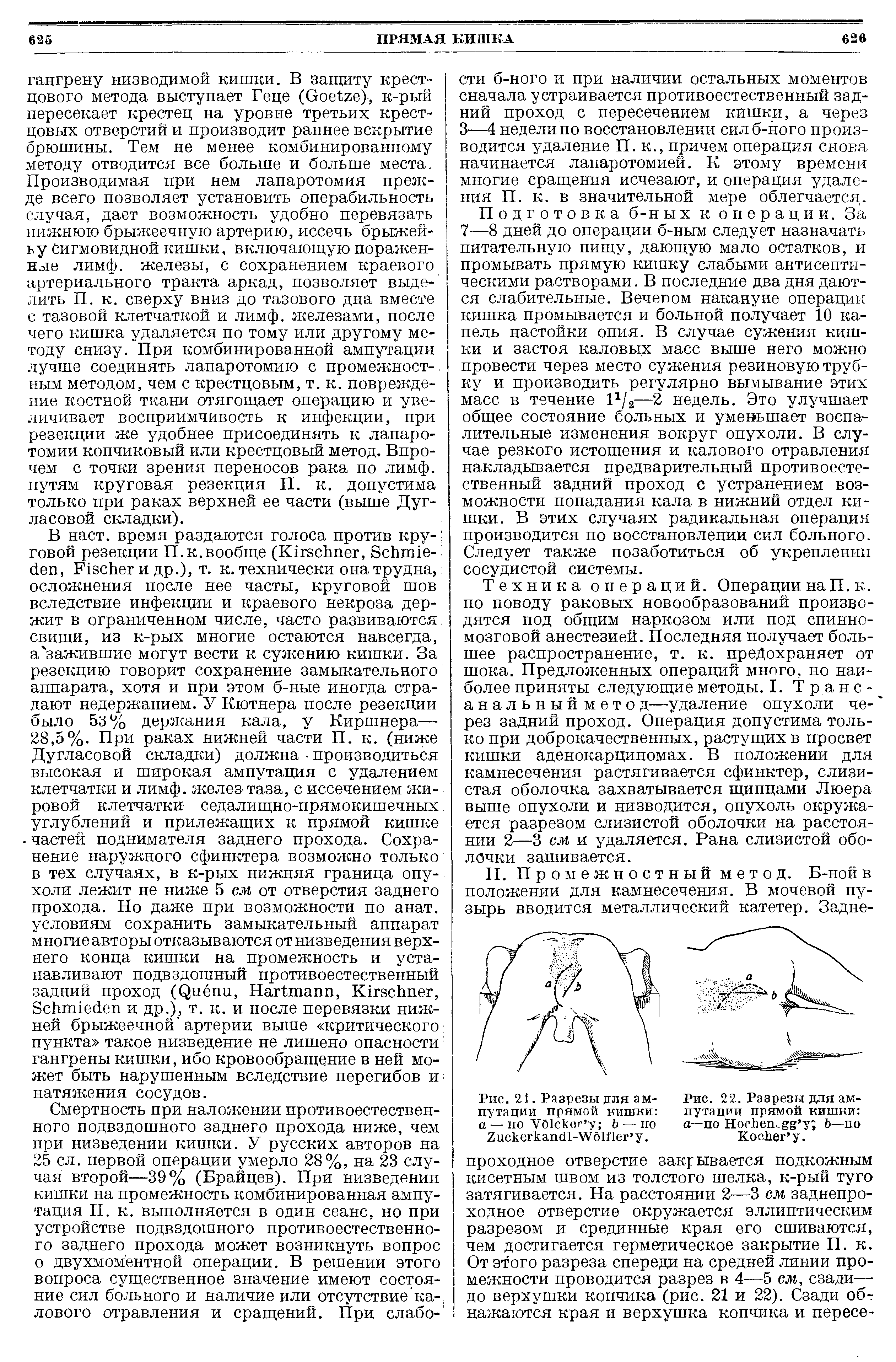 Рис. 21. Разрезы для ампутации прямой кишки а — по УО1скег у Ь — по /искегкашЛ-УУдШег у.