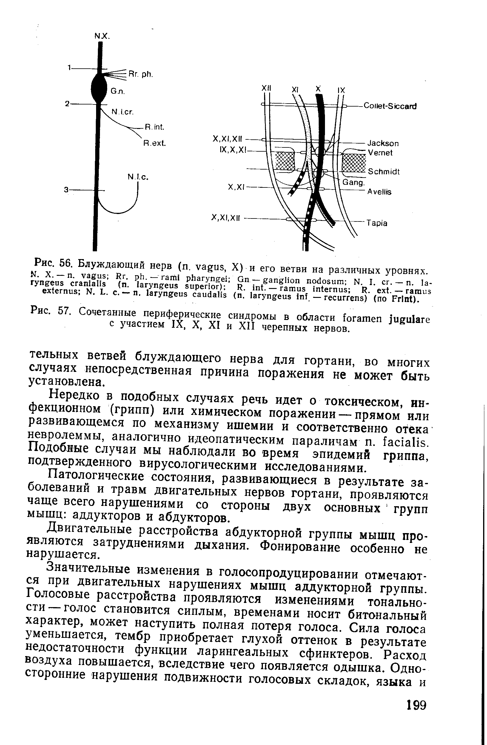 Рис. 57. Сочетанные периферические синдромы в области с участием IX, X, XI и XII черепных нервов.