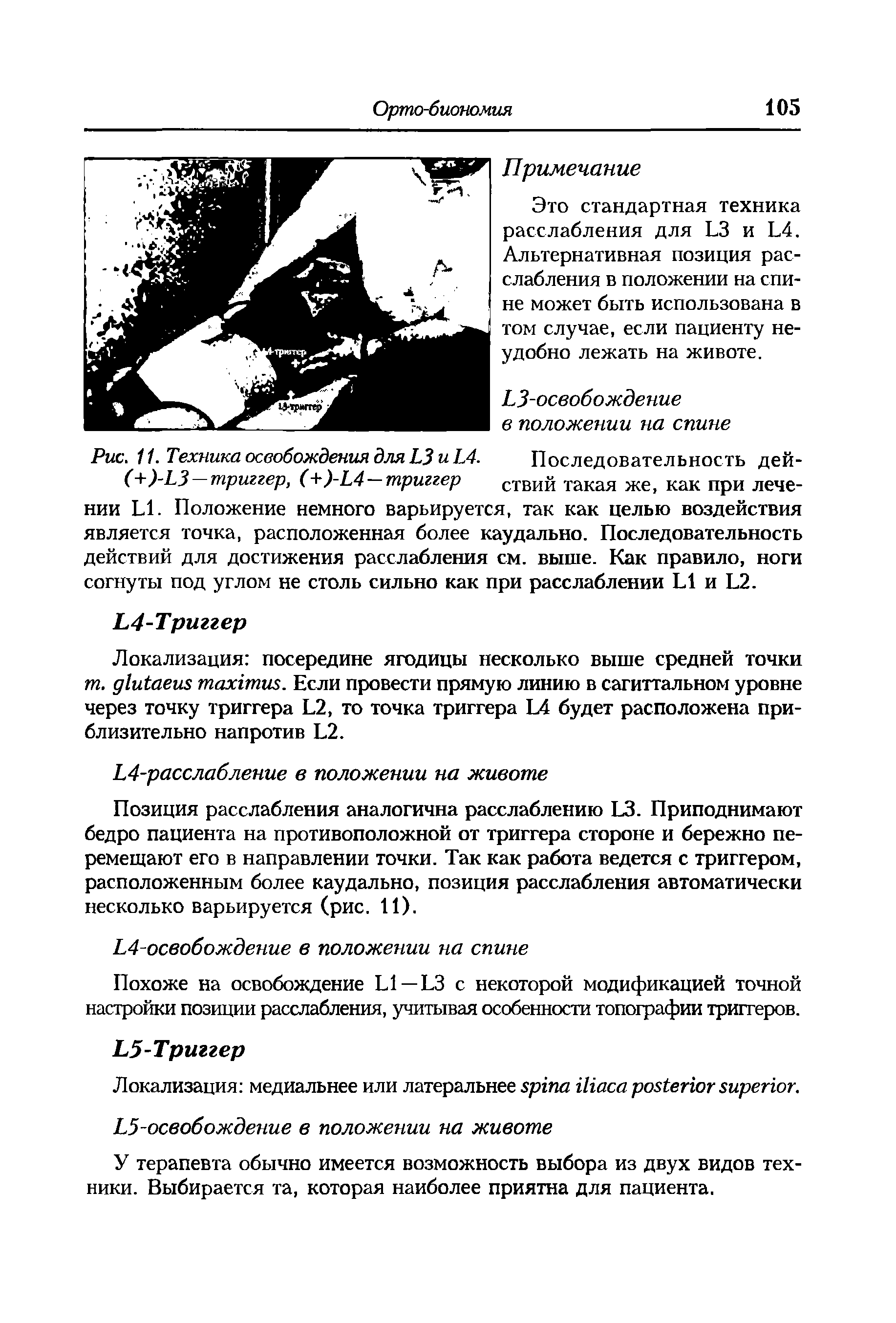 Рис. 11. Техника освобождения для 13 и Ь4. Последовательность дей-(+)-ЬЗ —триггер, (+)-Ь4—триггер ствий такая же, как при лече-...