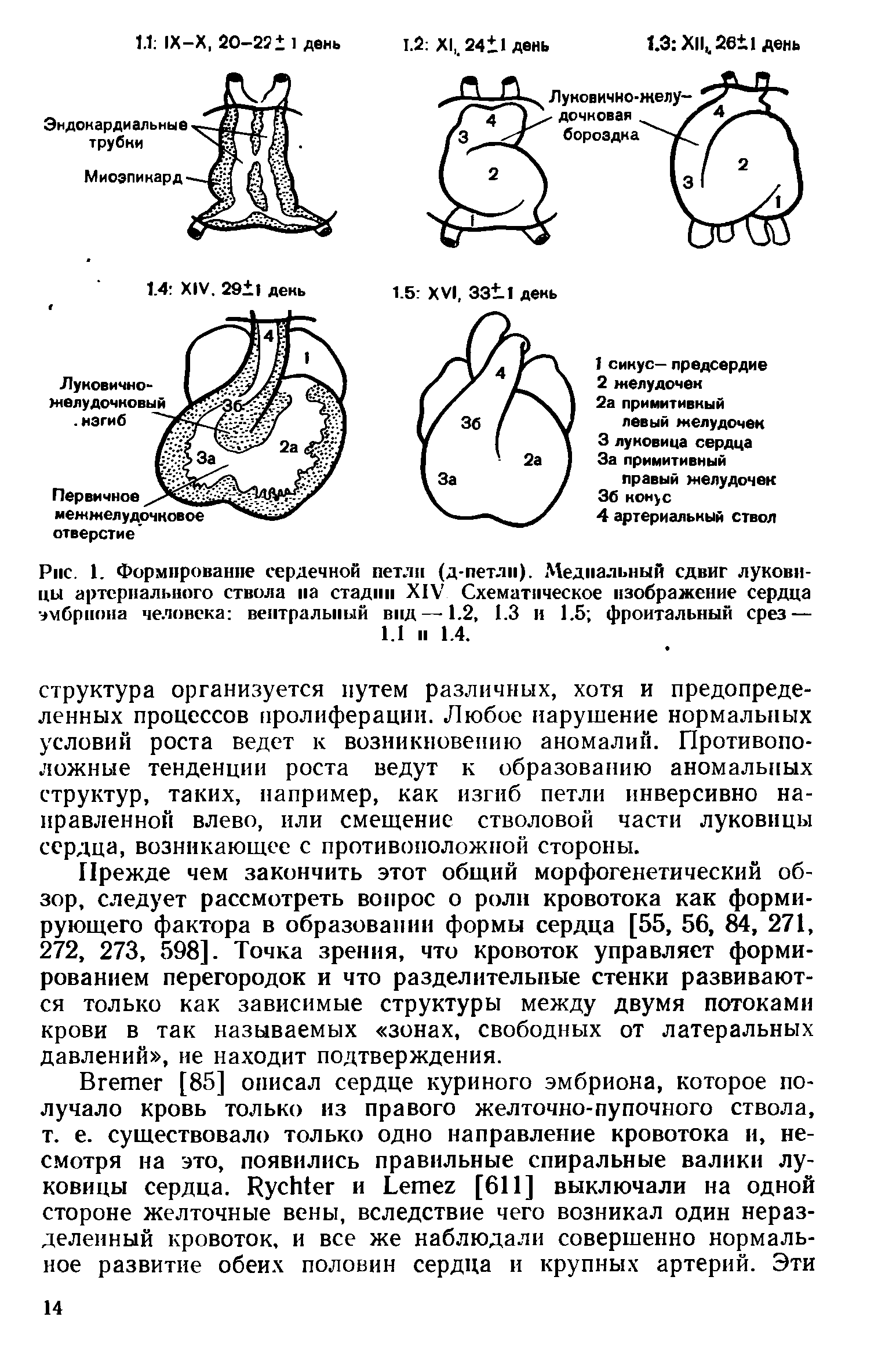 Рис. 1. Формирование сердечной петли (д-петлп). Медиальный сдвиг луковицы артериального ствола на стадии XIV Схематическое изображение сердца эмбриона человека вентральный вид—-1.2, 1.3 и 1.5 фронтальный срез — 1.1 п 1.4.
