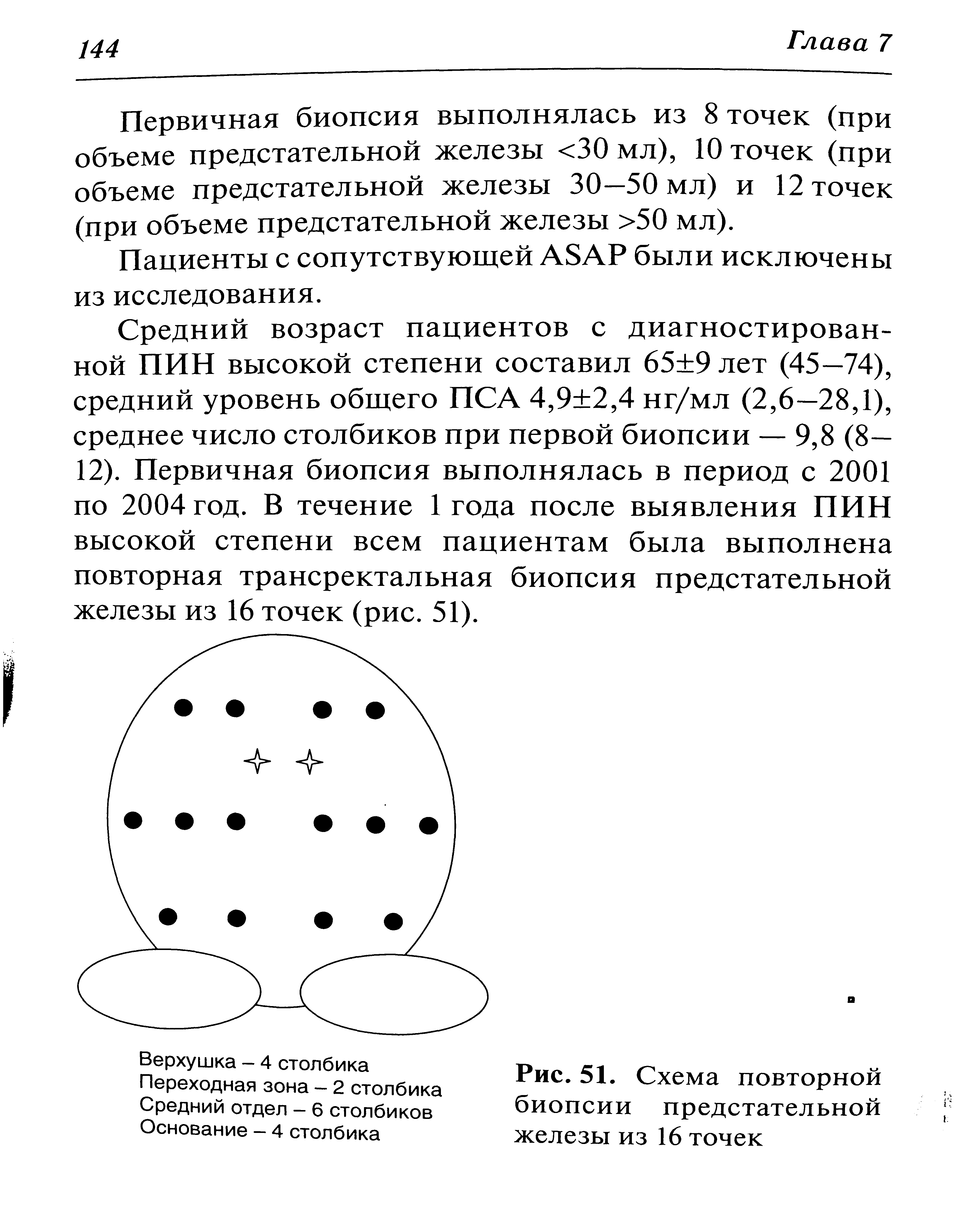 Рис. 51. Схема повторной биопсии предстательной железы из 16 точек...