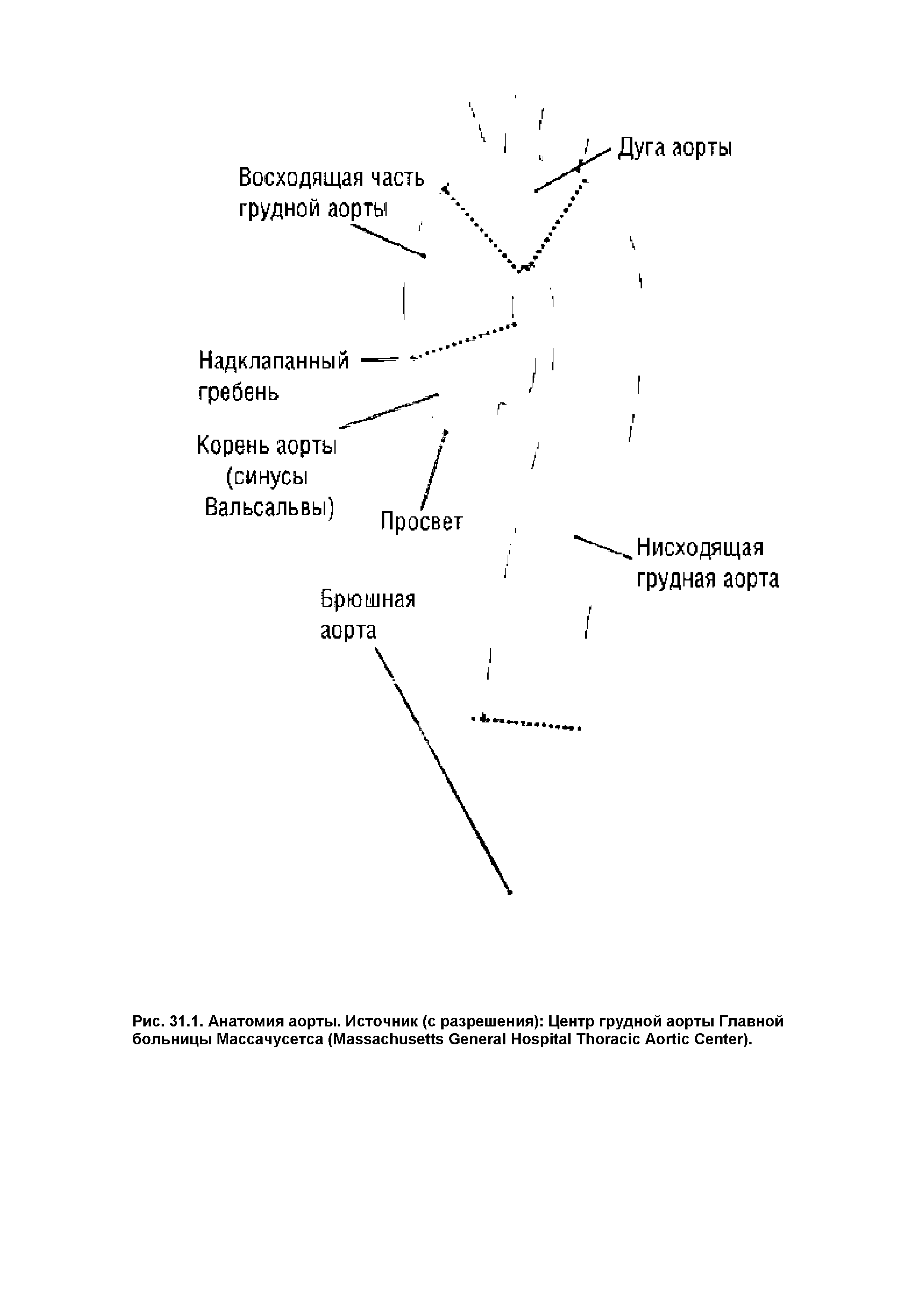 Рис. 31.1. Анатомия аорты. Источник (с разрешения) Центр грудной аорты Главной больницы Массачусетса (M G H T A C ).