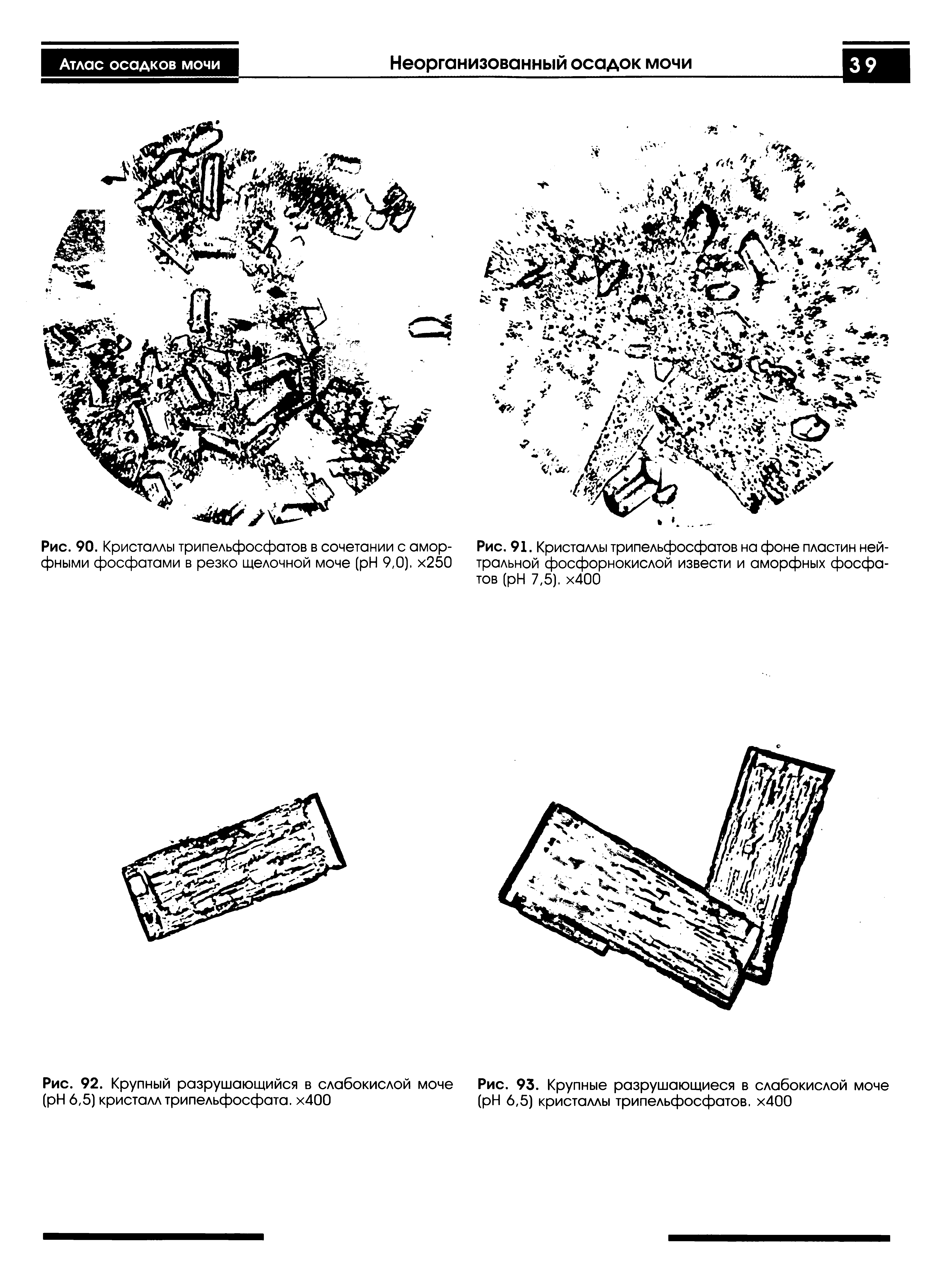 Рис. 91. Кристаллы трипельфосфатов на фоне пластин нейтральной фосфорнокислой извести и аморфных фосфатов ( H 7,5). х400...