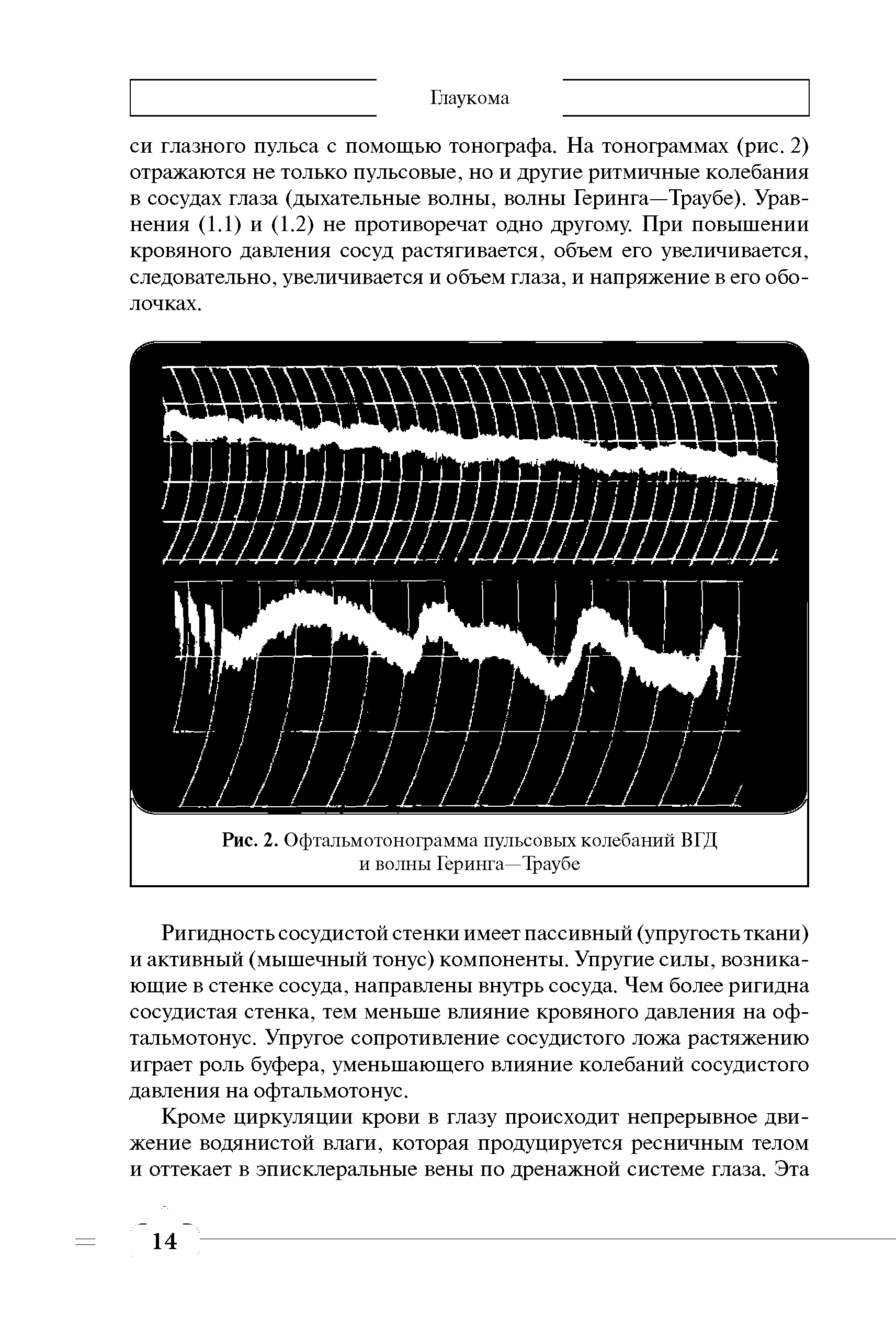 Рис. 2. Офтальмотонограмма пульсовых колебаний ВГД и волны Геринга—Траубе...