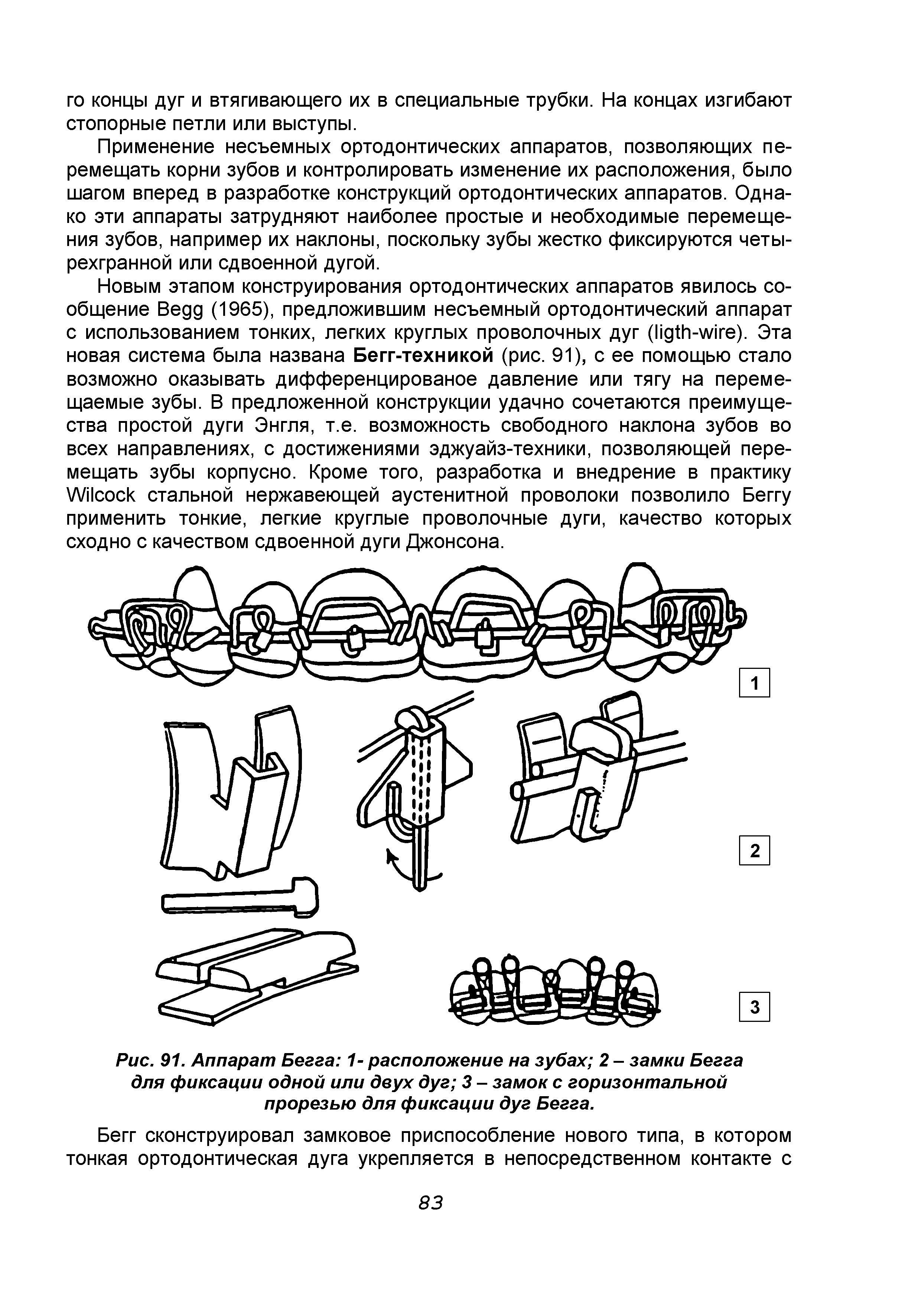 Рис. 91. Аппарат Бегга 1- расположение на зубах 2 - замки Бегга для фиксации одной или двух дуг 3 - замок с горизонтальной прорезью для фиксации дуг Бегга.