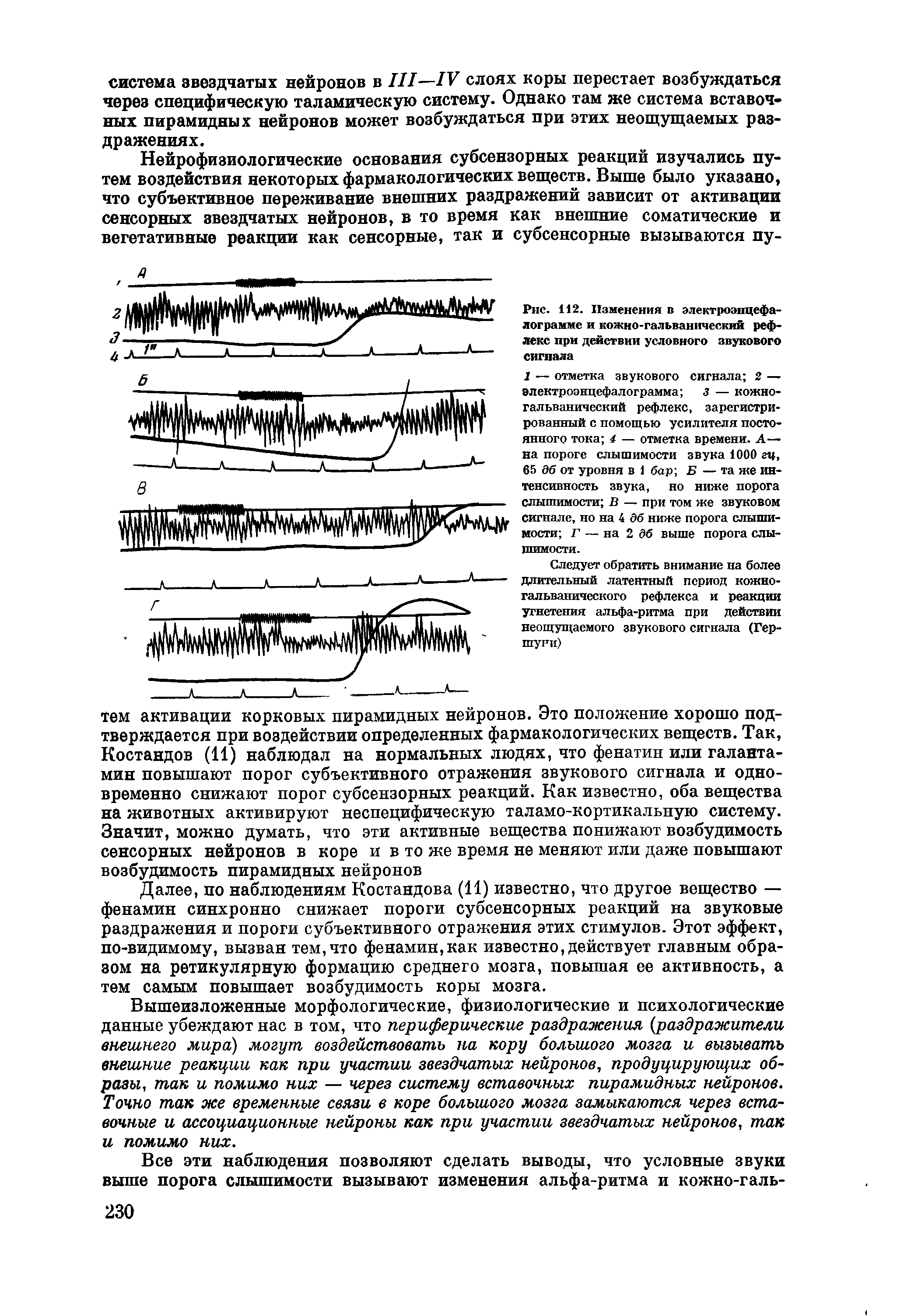 Рис. 112. Изменения в электроэнцефалограмме и кожно-гальванический рефлекс при действии условного звукового сигнала...