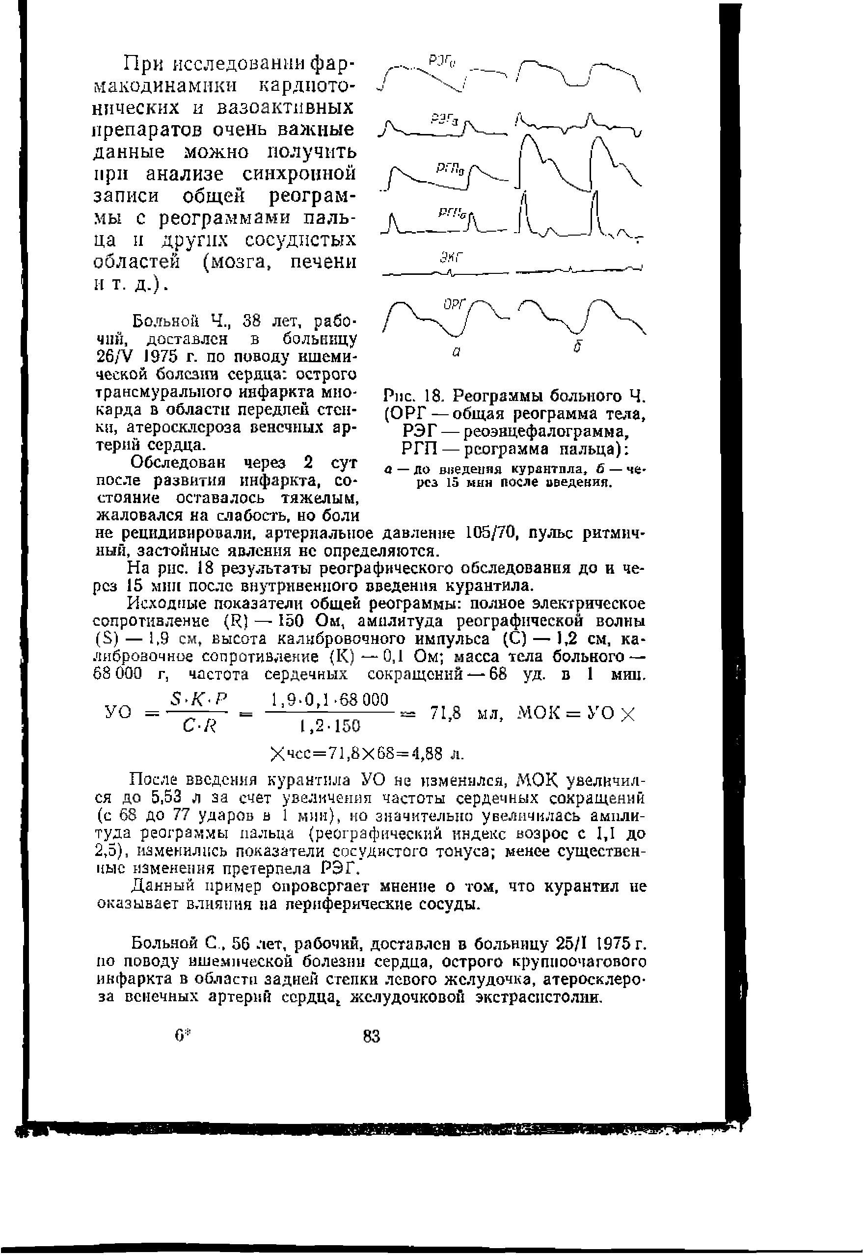 Рис. 18. Реограммы больного Ч. (ОРГ — общая реограмма тела, РЭГ — реоэнцефалограмма, РГП — реограмма пальца) а — до внеденяя курацтпла б — через 15 мин после введения.