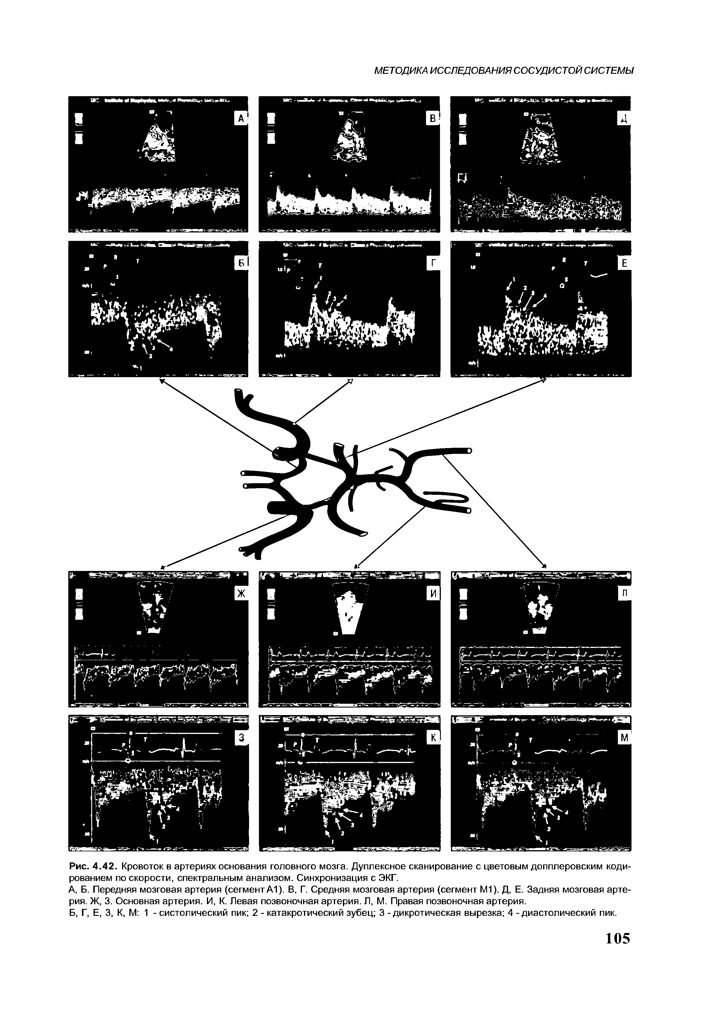 Рис. 4.42. Кровоток в артериях основания головного мозга. Дуплексное сканирование с цветовым допплеровским кодированием по скорости, спектральным анализом. Синхронизация с ЭКГ.
